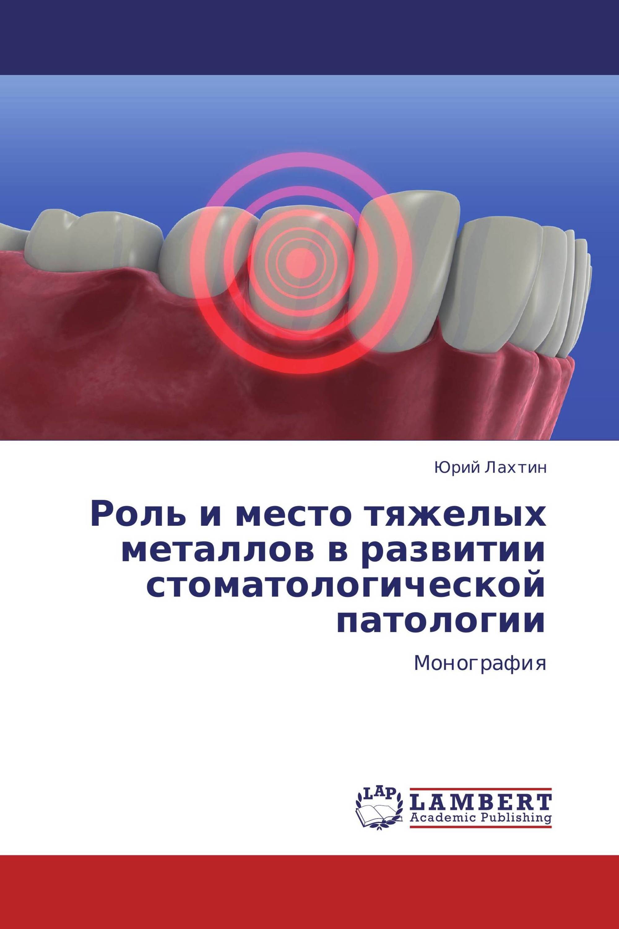 Роль и место тяжелых металлов в развитии стоматологической патологии