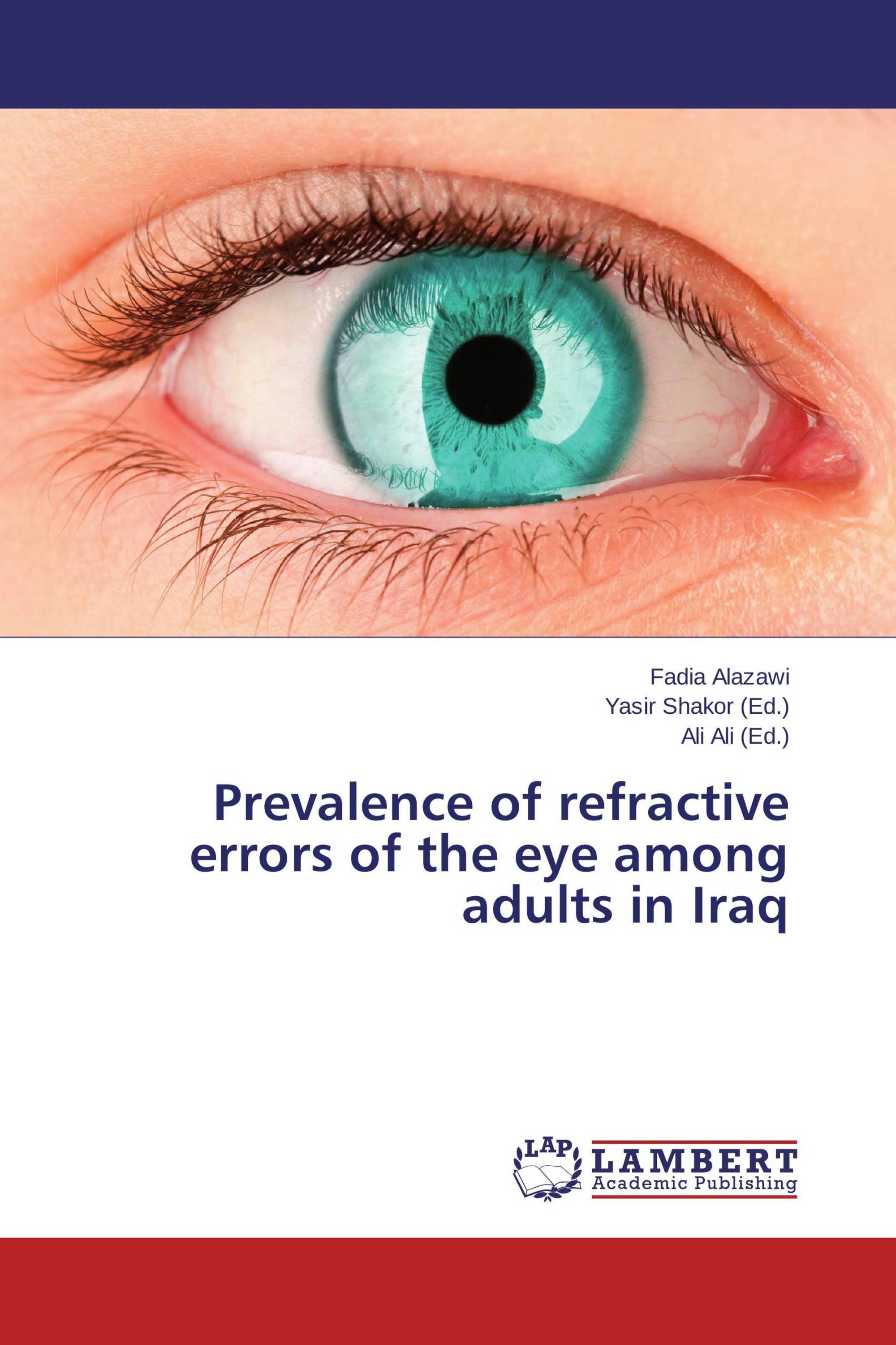 Prevalence of refractive errors of the eye among adults in Iraq