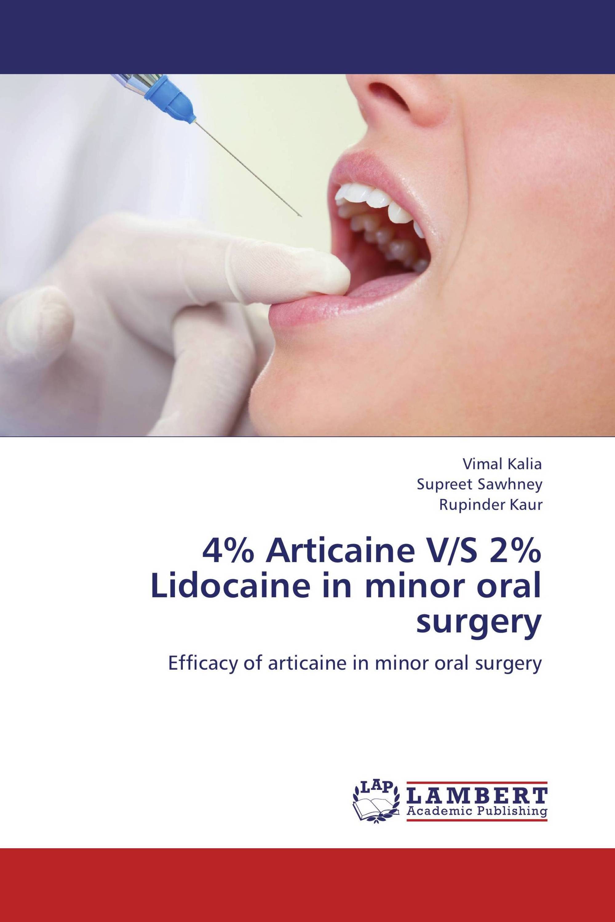 4% Articaine V/S 2% Lidocaine in minor oral surgery