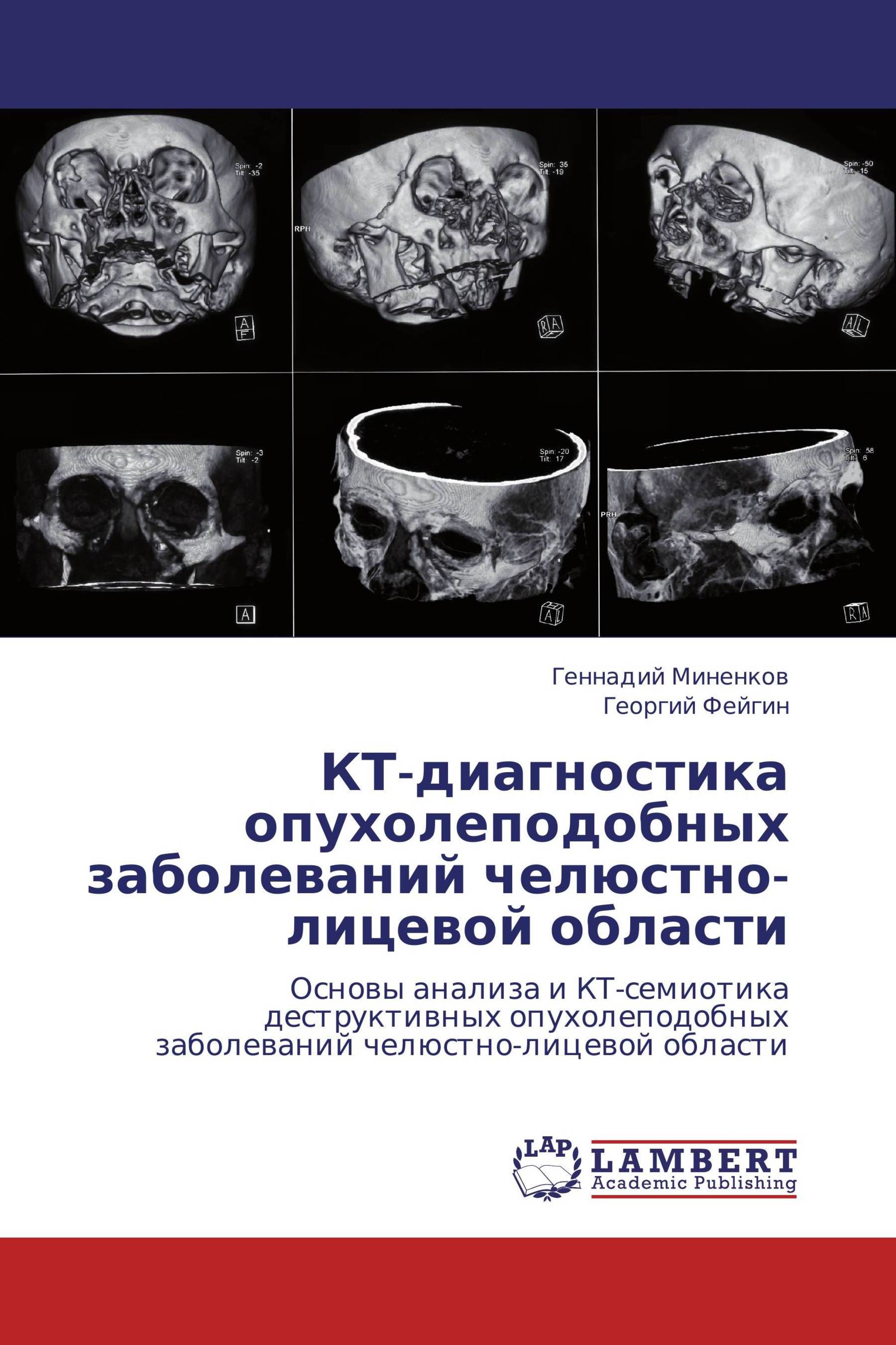 КТ-диагностика опухолеподобных заболеваний челюстно-лицевой области