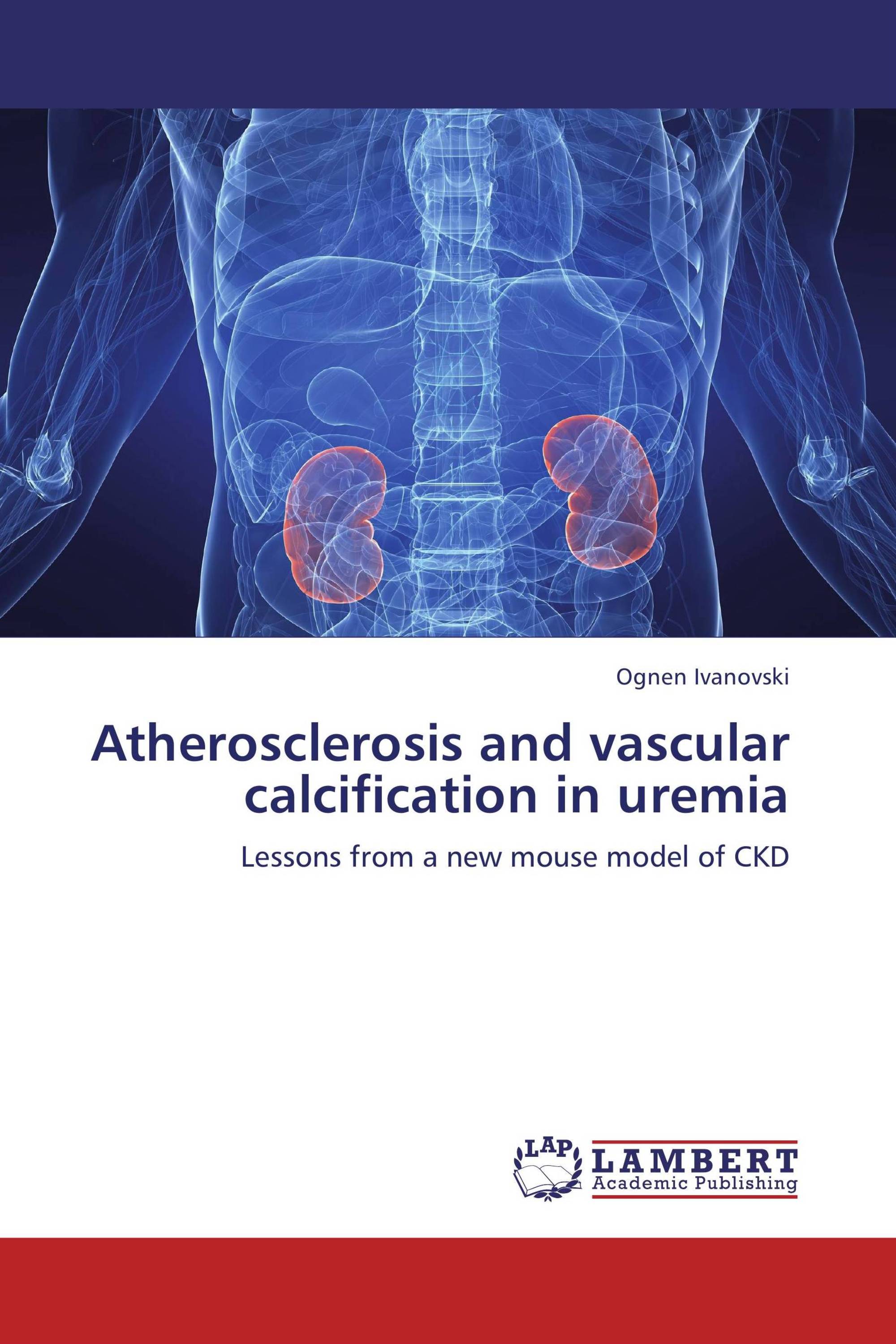 Atherosclerosis and vascular calcification in uremia