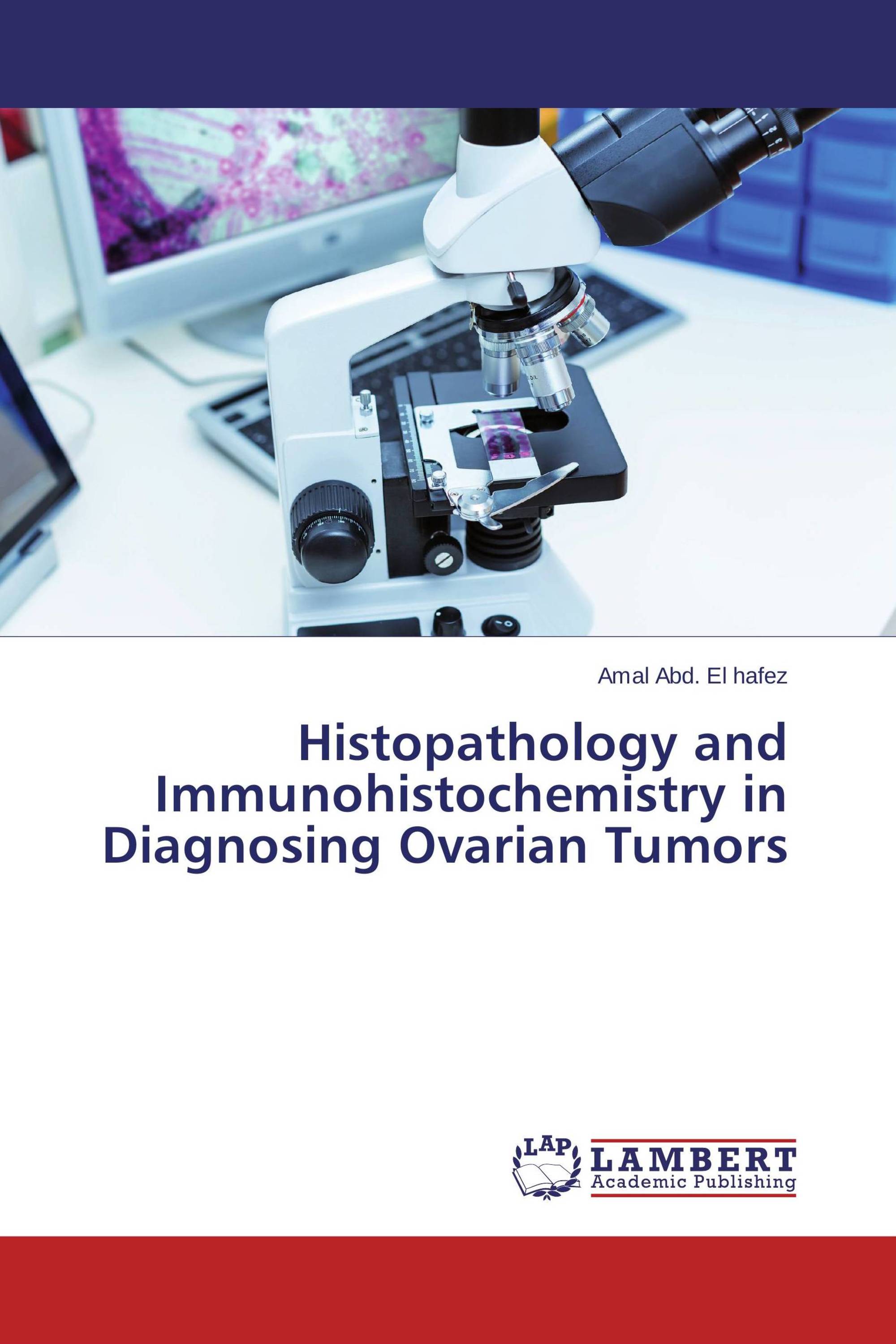 Histopathology and Immunohistochemistry in Diagnosing Ovarian Tumors