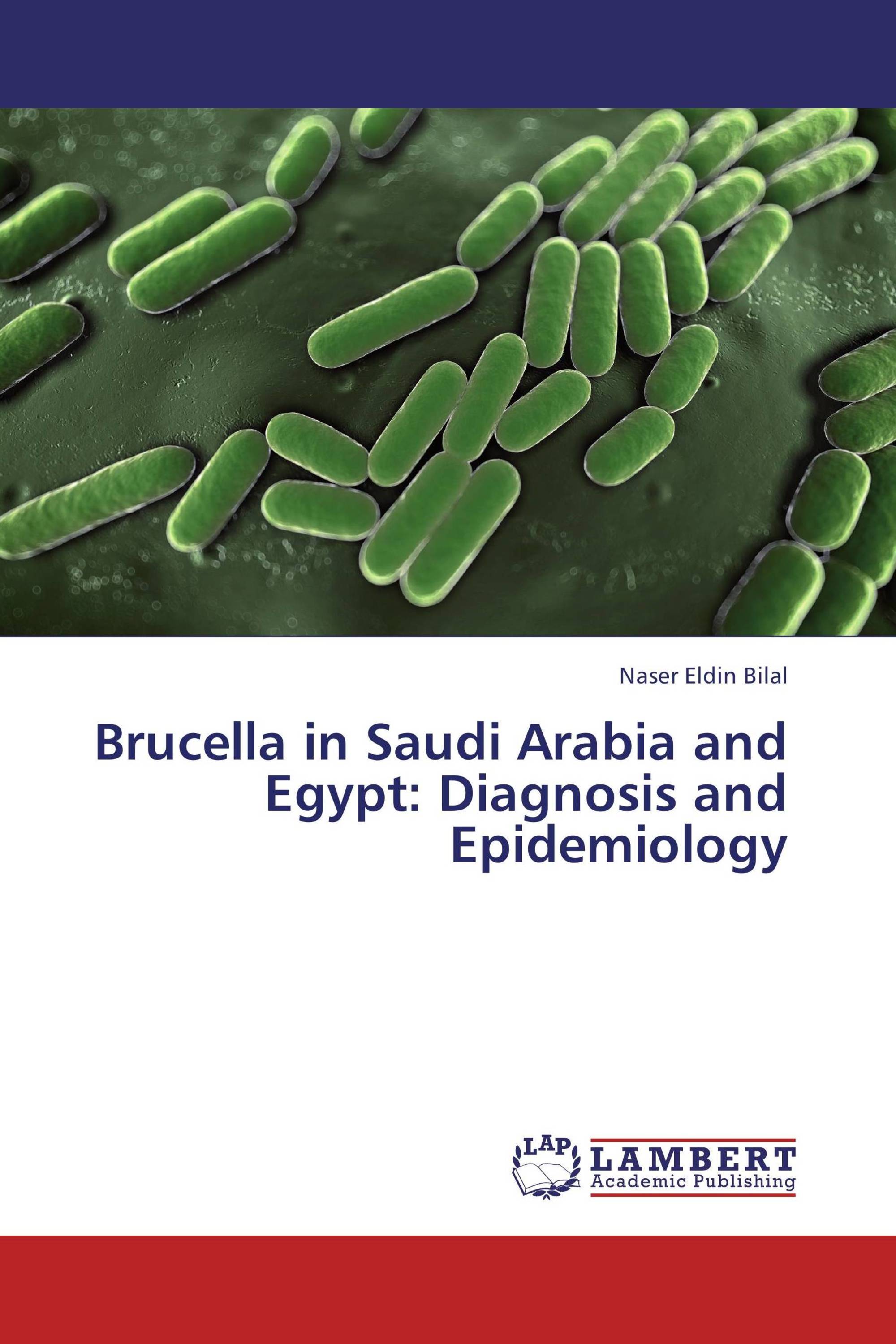 Brucella in Saudi Arabia and Egypt: Diagnosis and Epidemiology