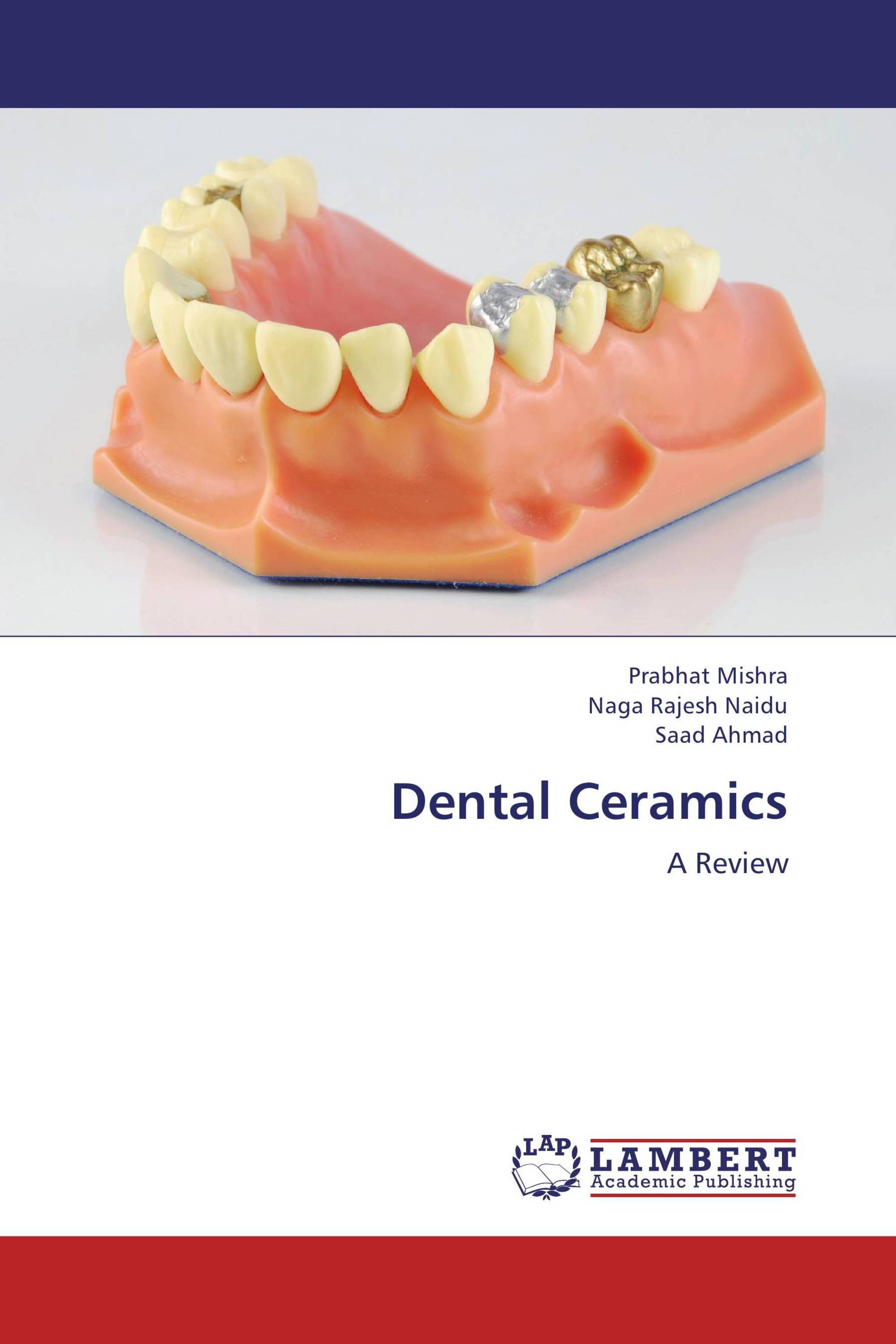 Dental Ceramics / 9783659332852 / 9783659332852 / 3659332852