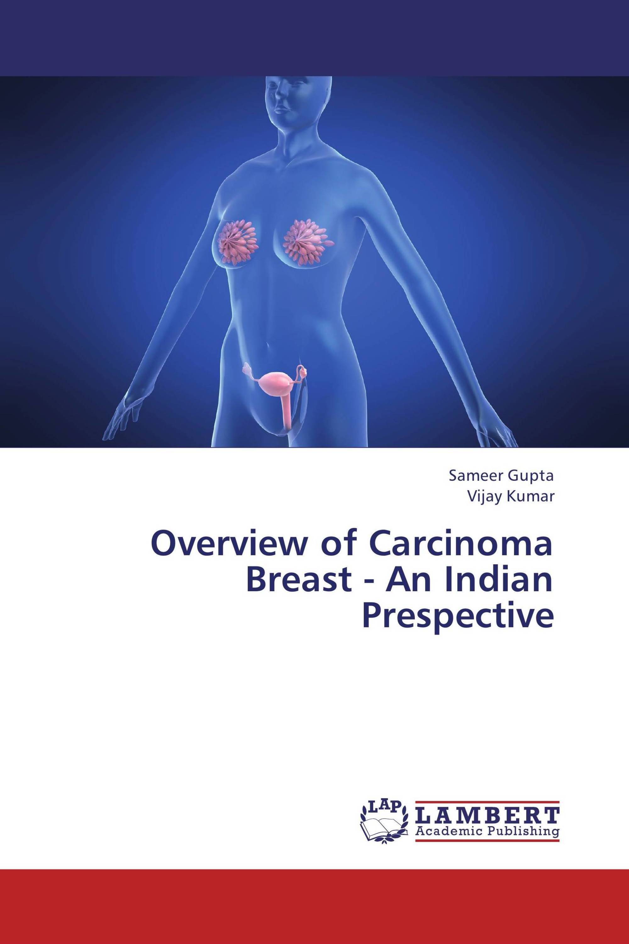 Overview of Carcinoma Breast - An Indian Prespective