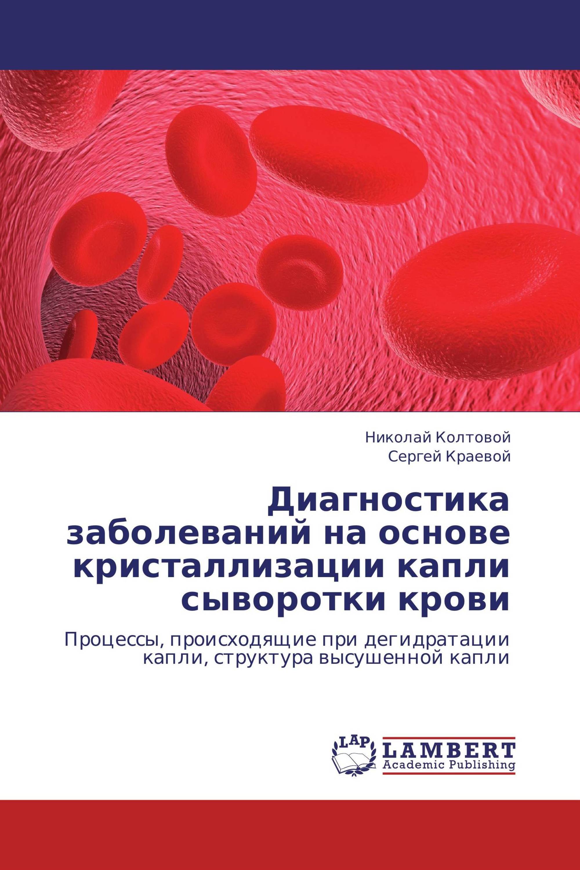 Диагностика заболеваний на основе кристаллизации капли сыворотки крови