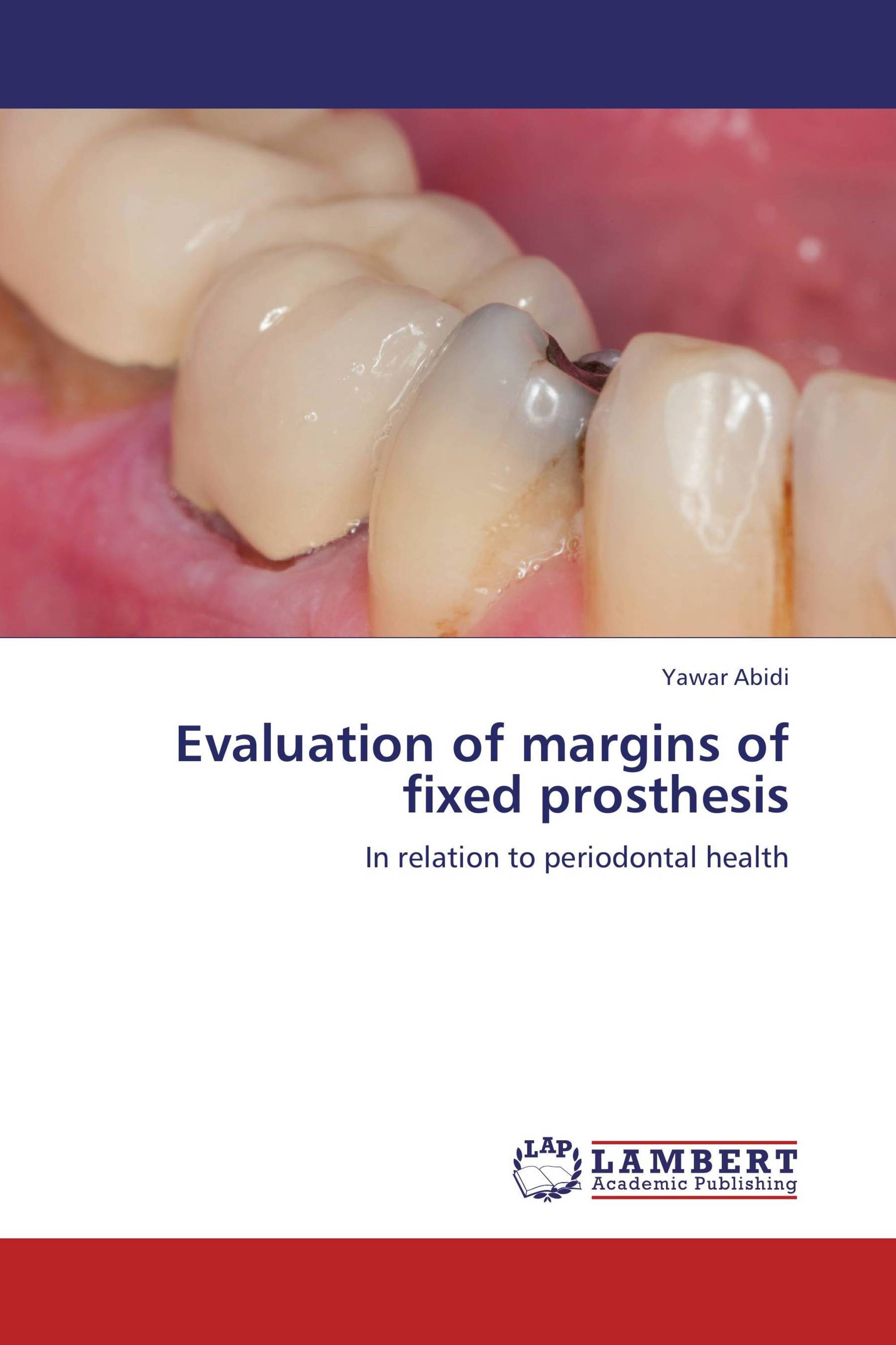 Evaluation of margins of fixed prosthesis