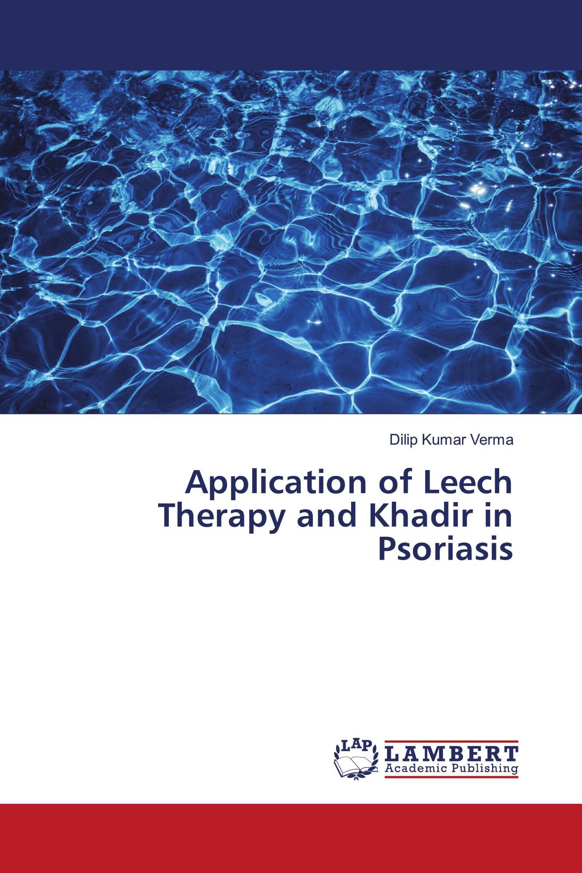 Application of Leech Therapy and Khadir in Psoriasis