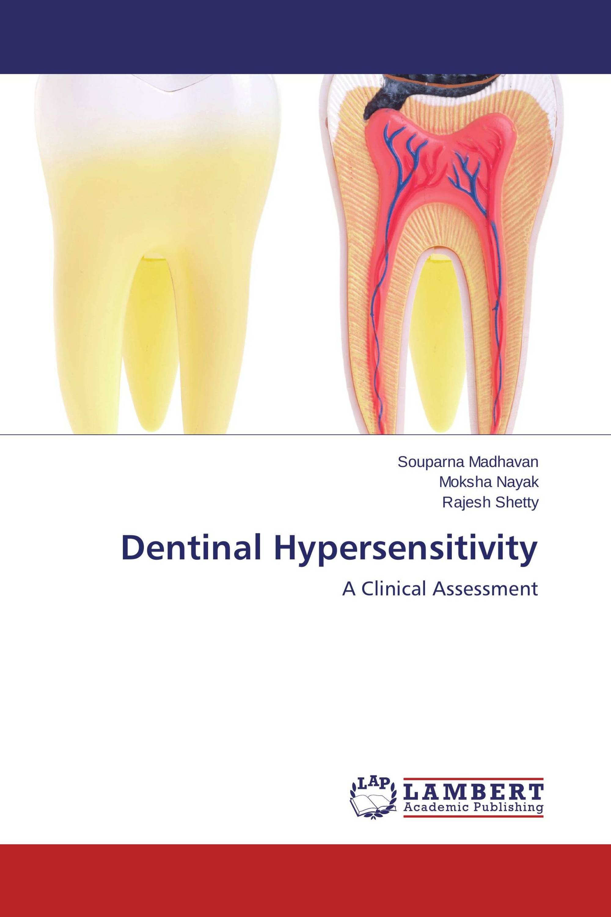 Dentinal Hypersensitivity / 9783659409929 / 9783659409929 / 3659409928
