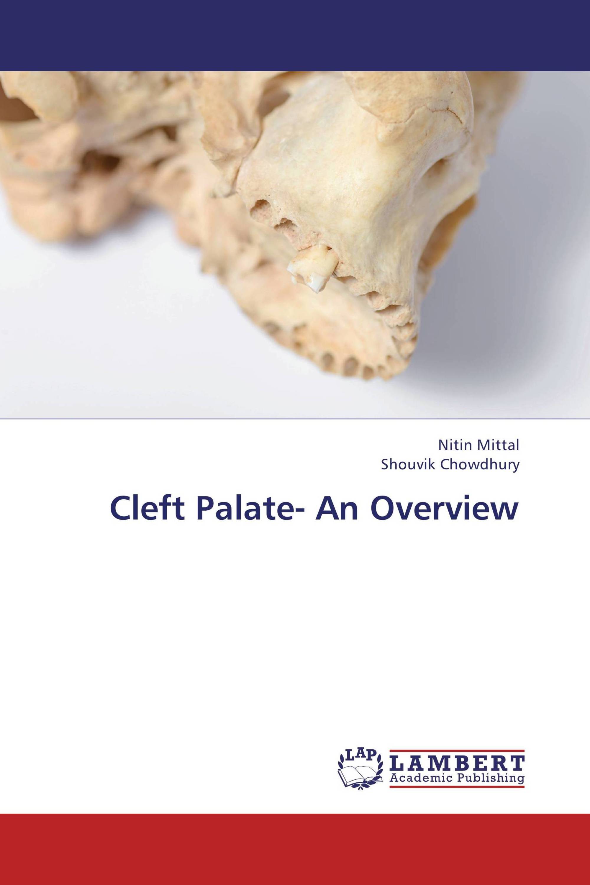 Cleft Palate- An Overview