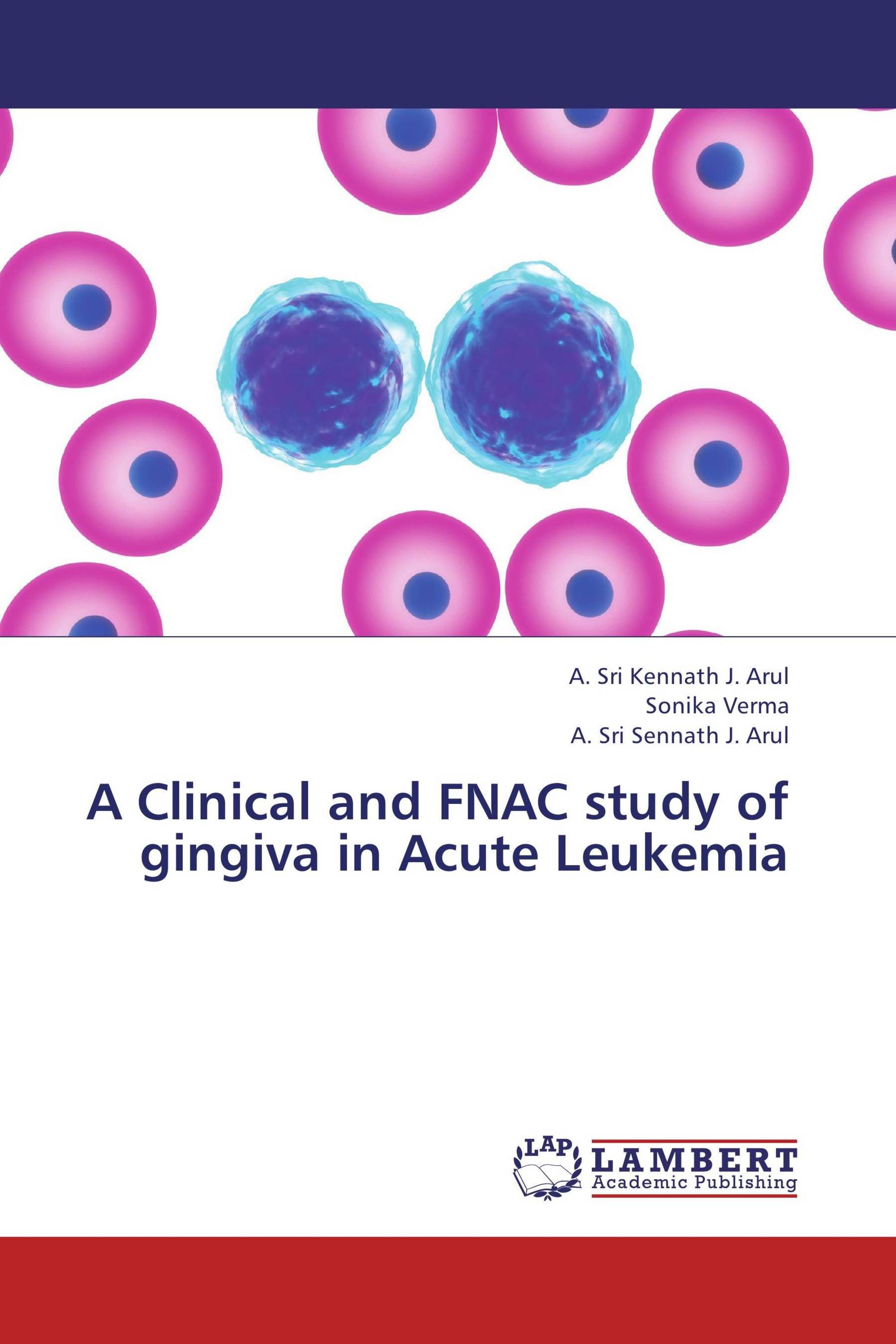 A Clinical and FNAC study of gingiva in Acute Leukemia