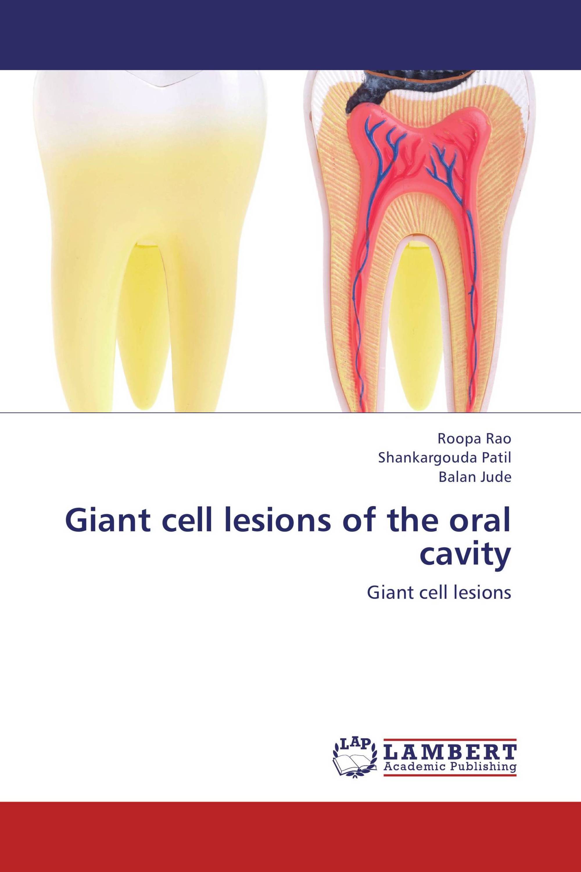 Giant cell lesions of the oral cavity