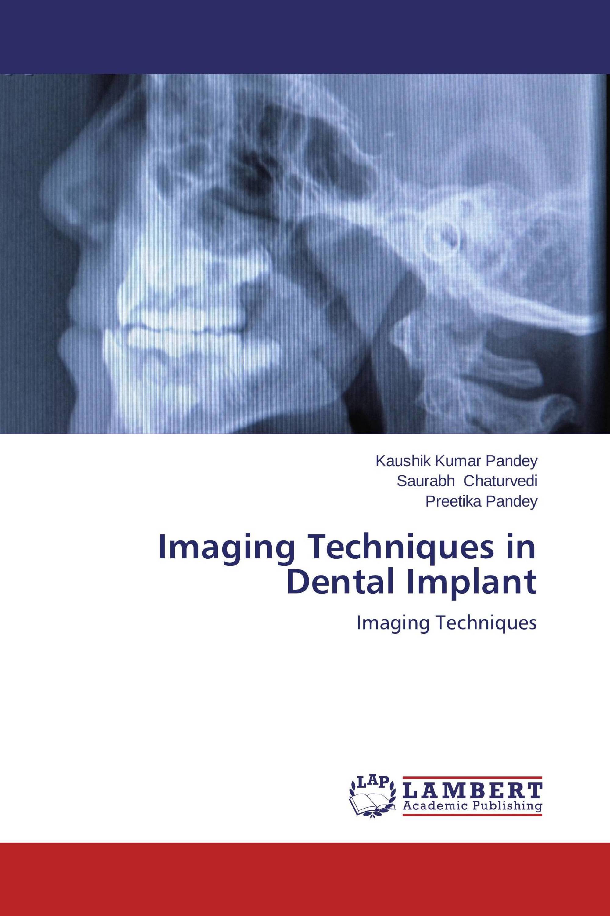 Imaging Techniques in Dental Implant / 9783659471070