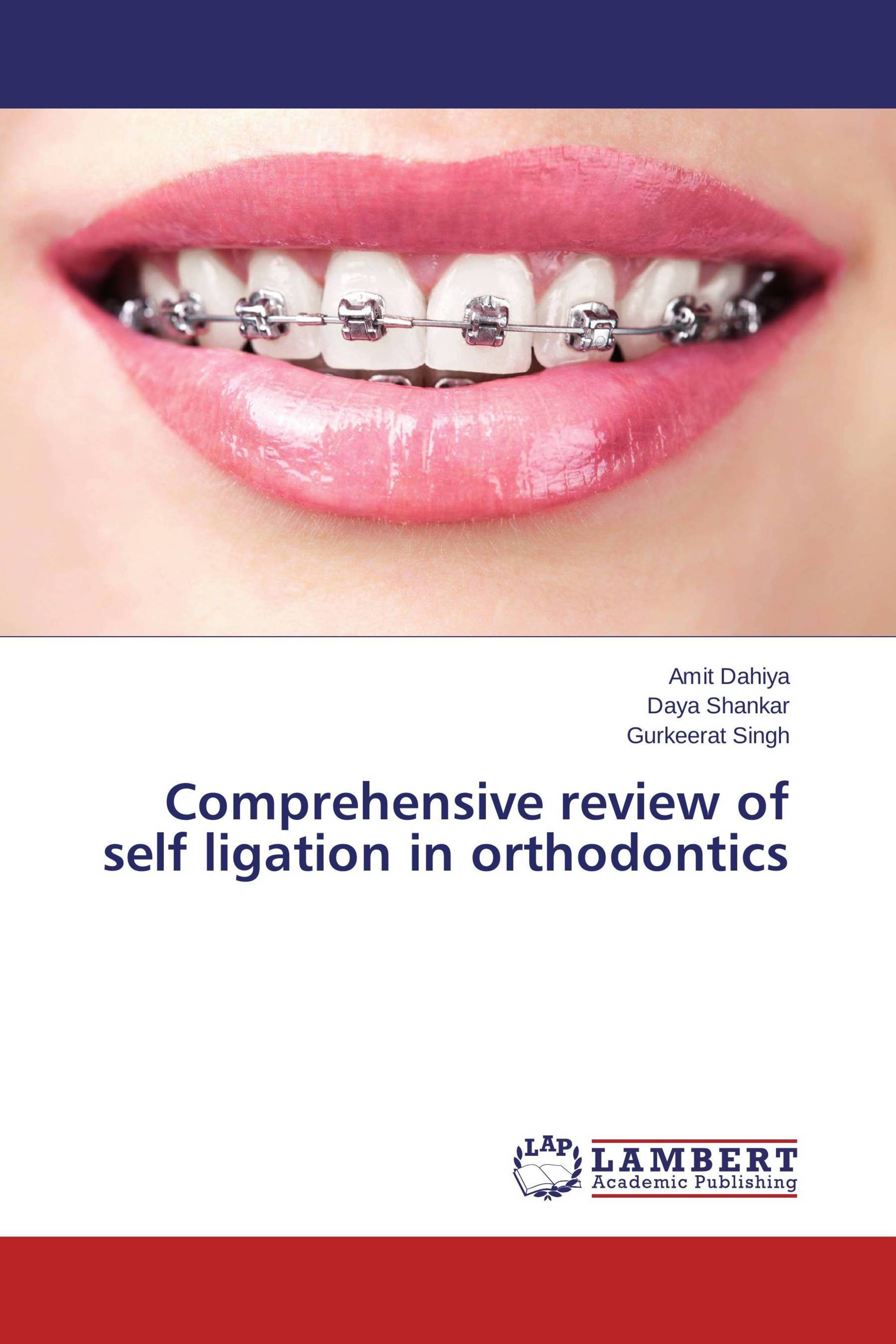 Comprehensive review of self ligation in orthodontics / 978365948995