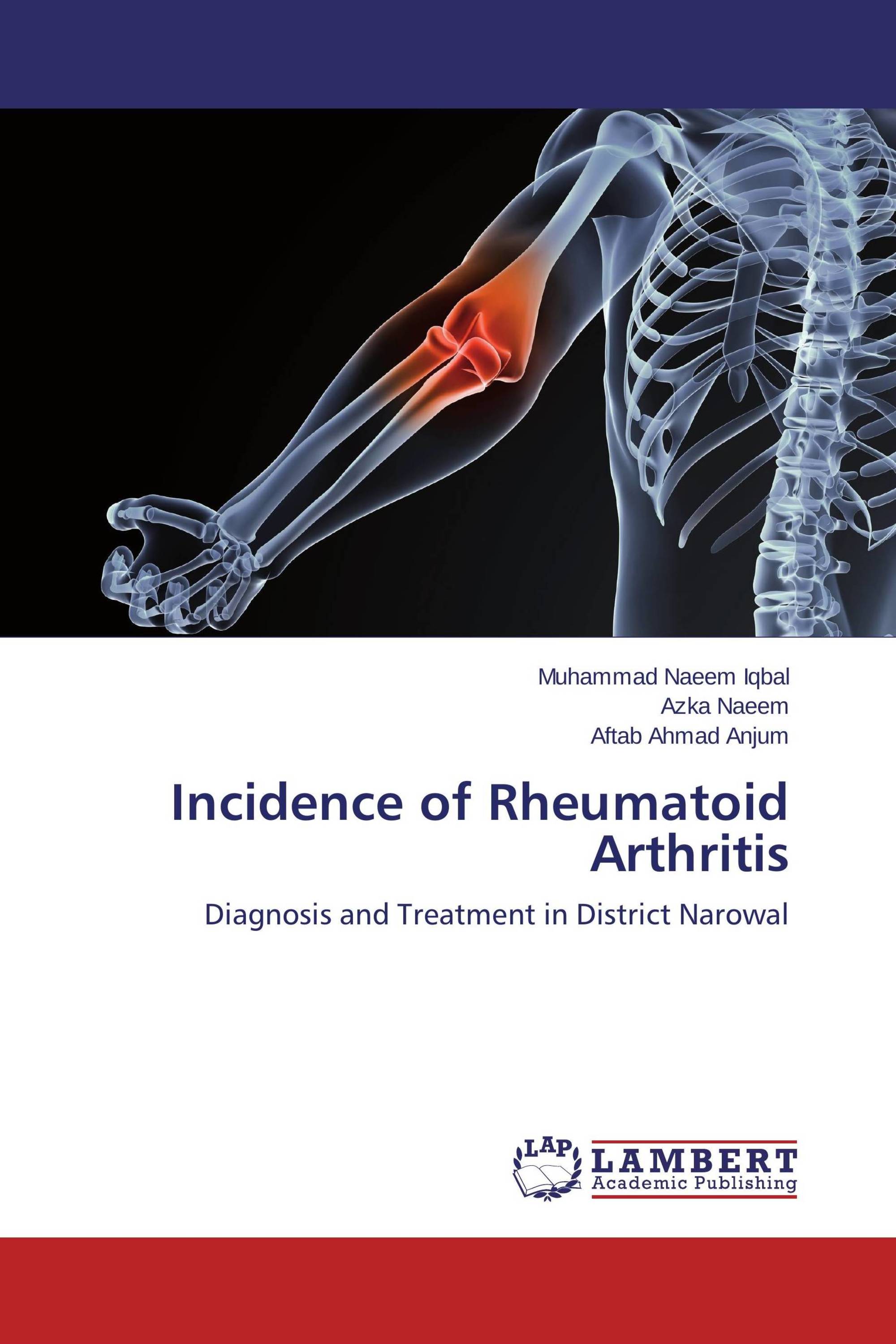 Incidence of Rheumatoid Arthritis / 978-3-659-50730-4 / 9783659507304 ...