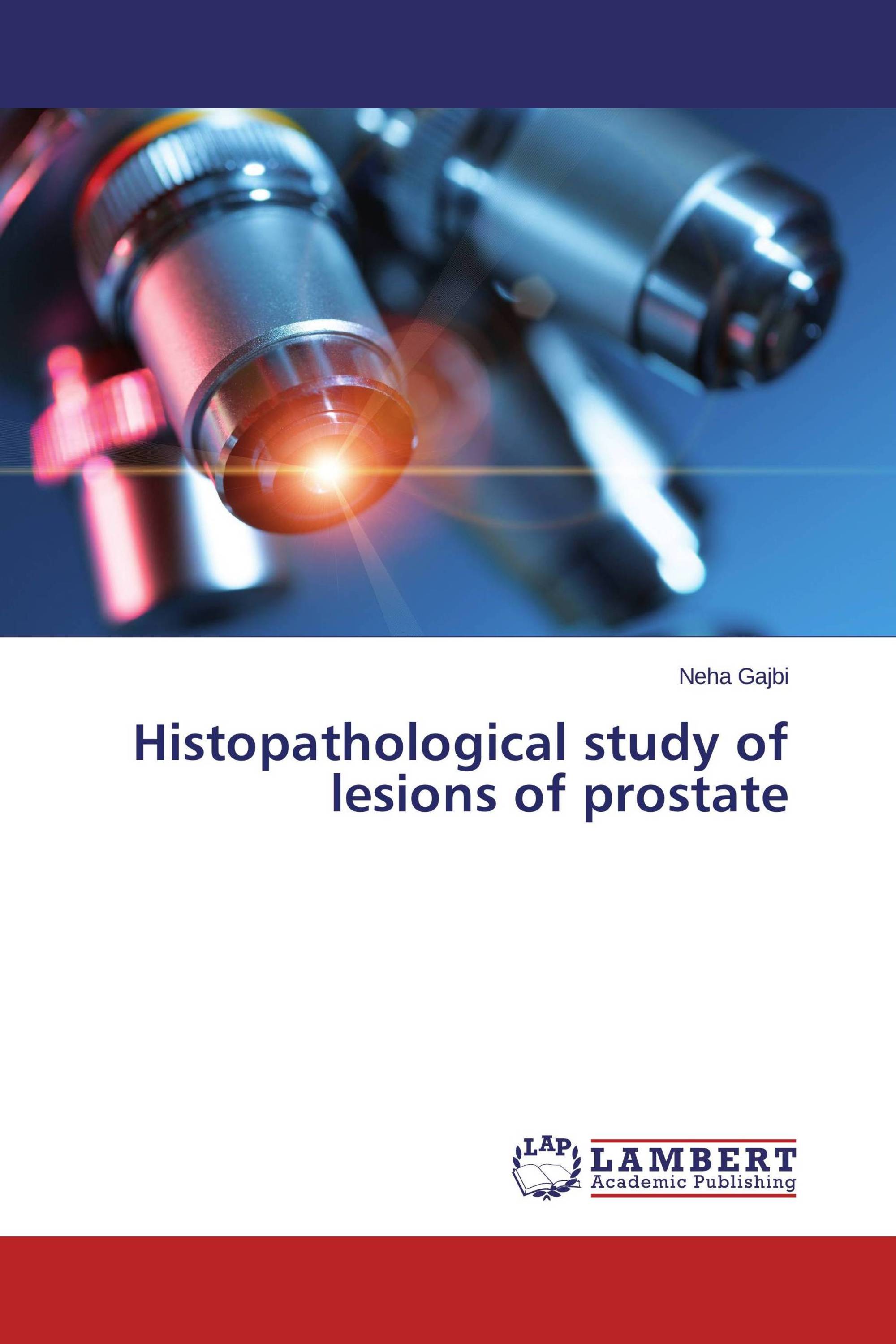 Histopathological study of lesions of prostate