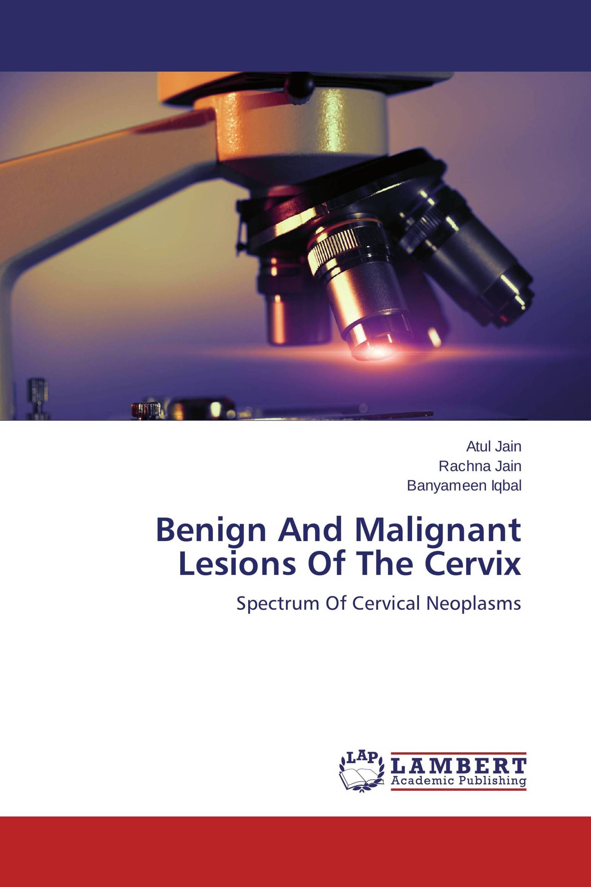 Benign And Malignant Lesions Of The Cervix