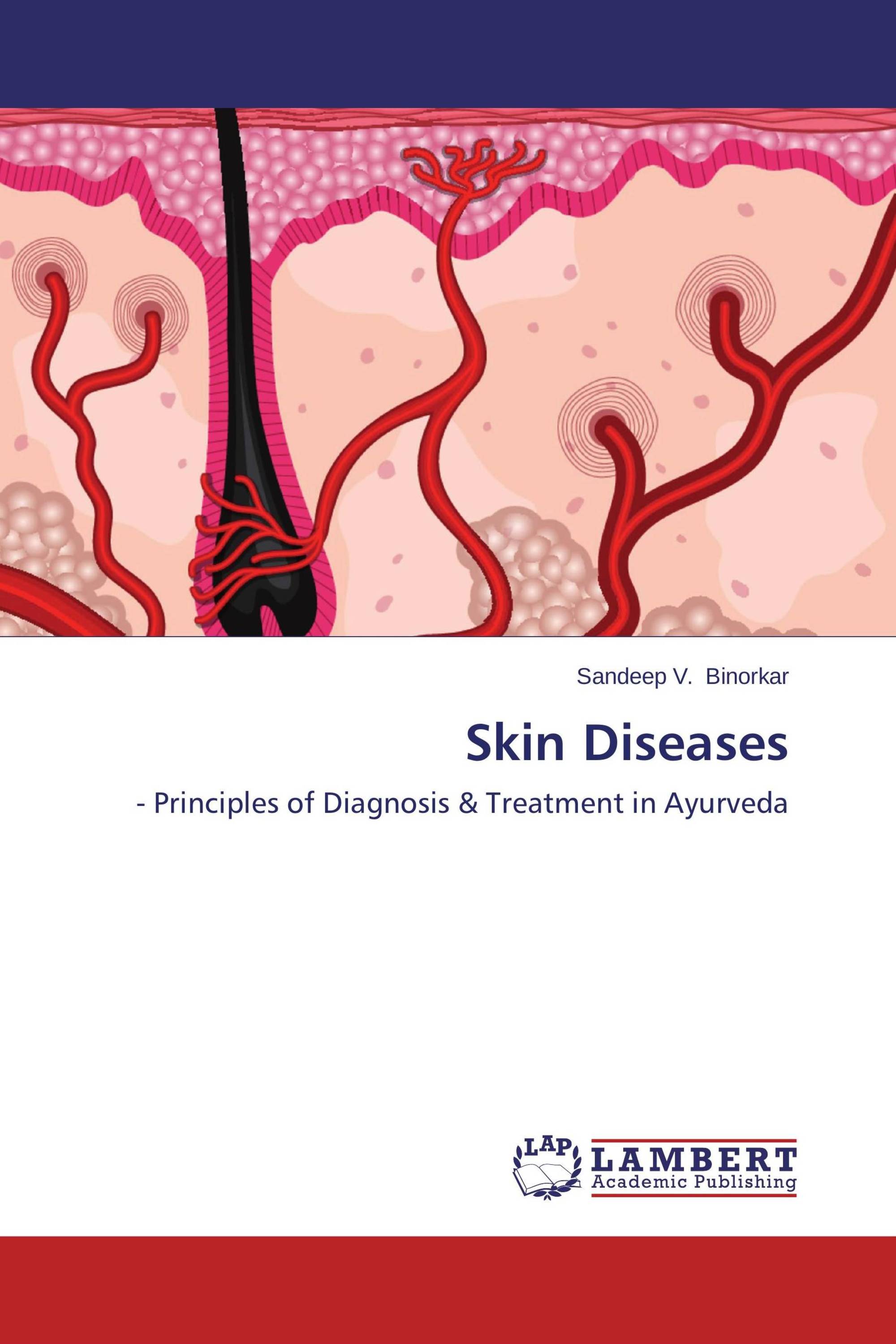 Skin Diseases