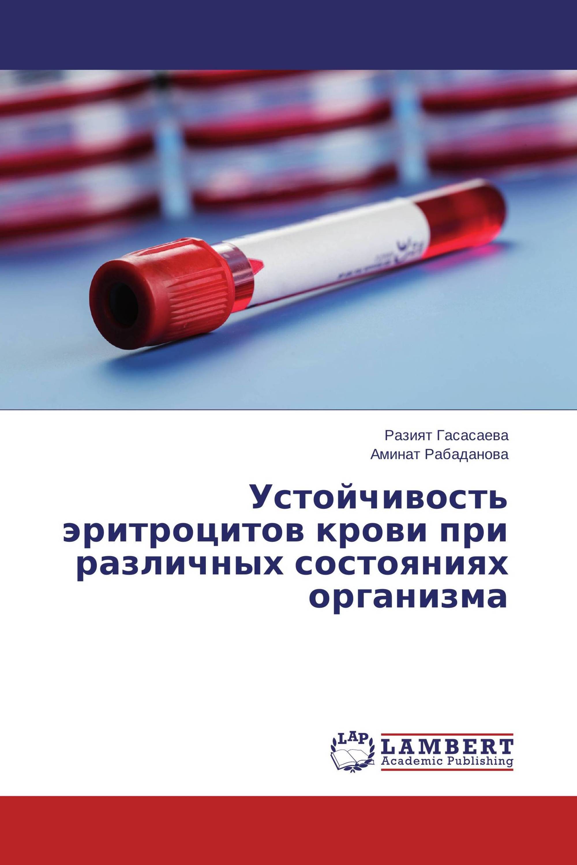 Определение резистентности эритроцитов. Стойкость эритроцитов. Кривая осмотической устойчивости эритроцитов. Пресепсин.