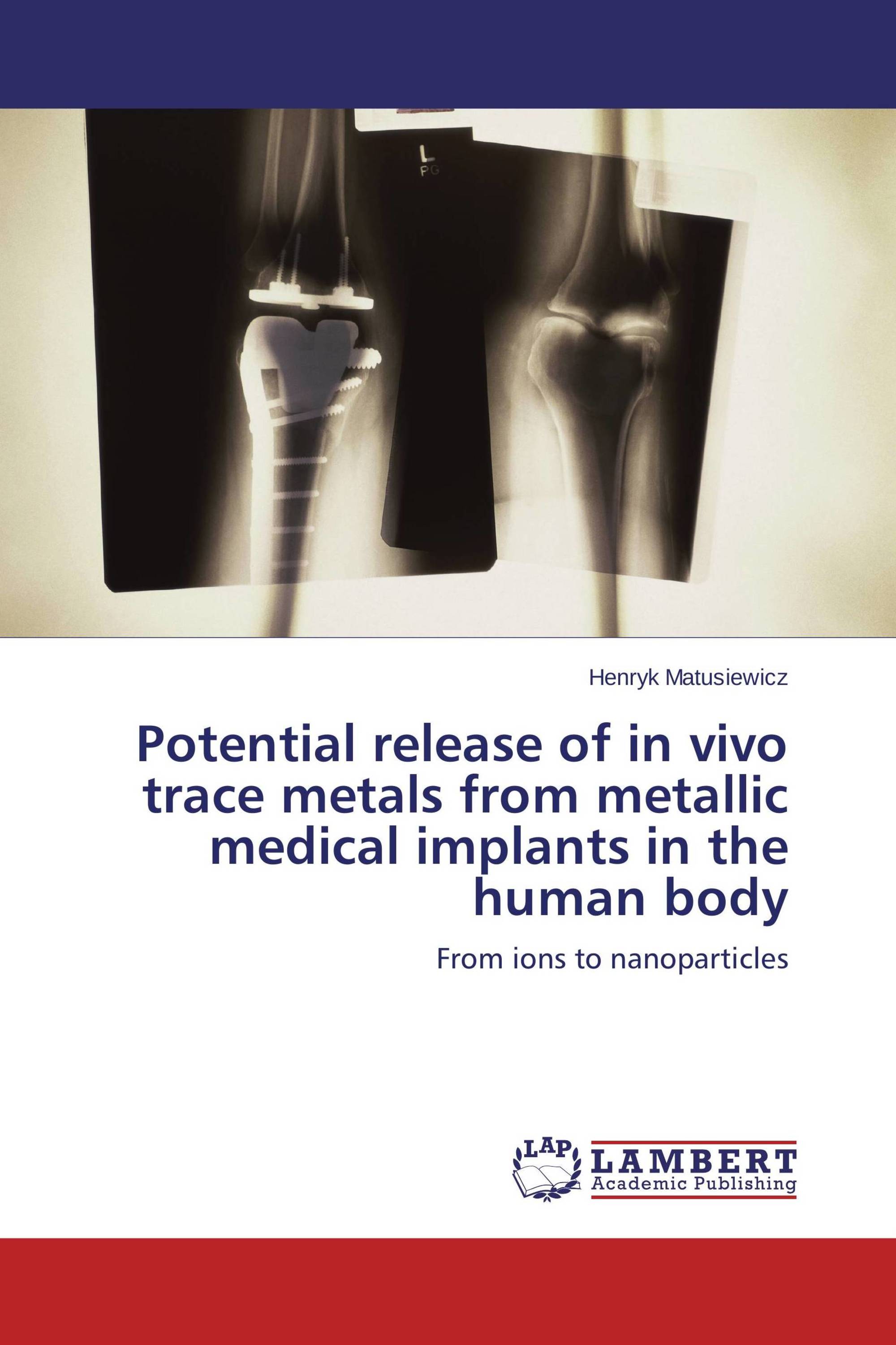 Potential release of in vivo trace metals from metallic medical implants in the human body