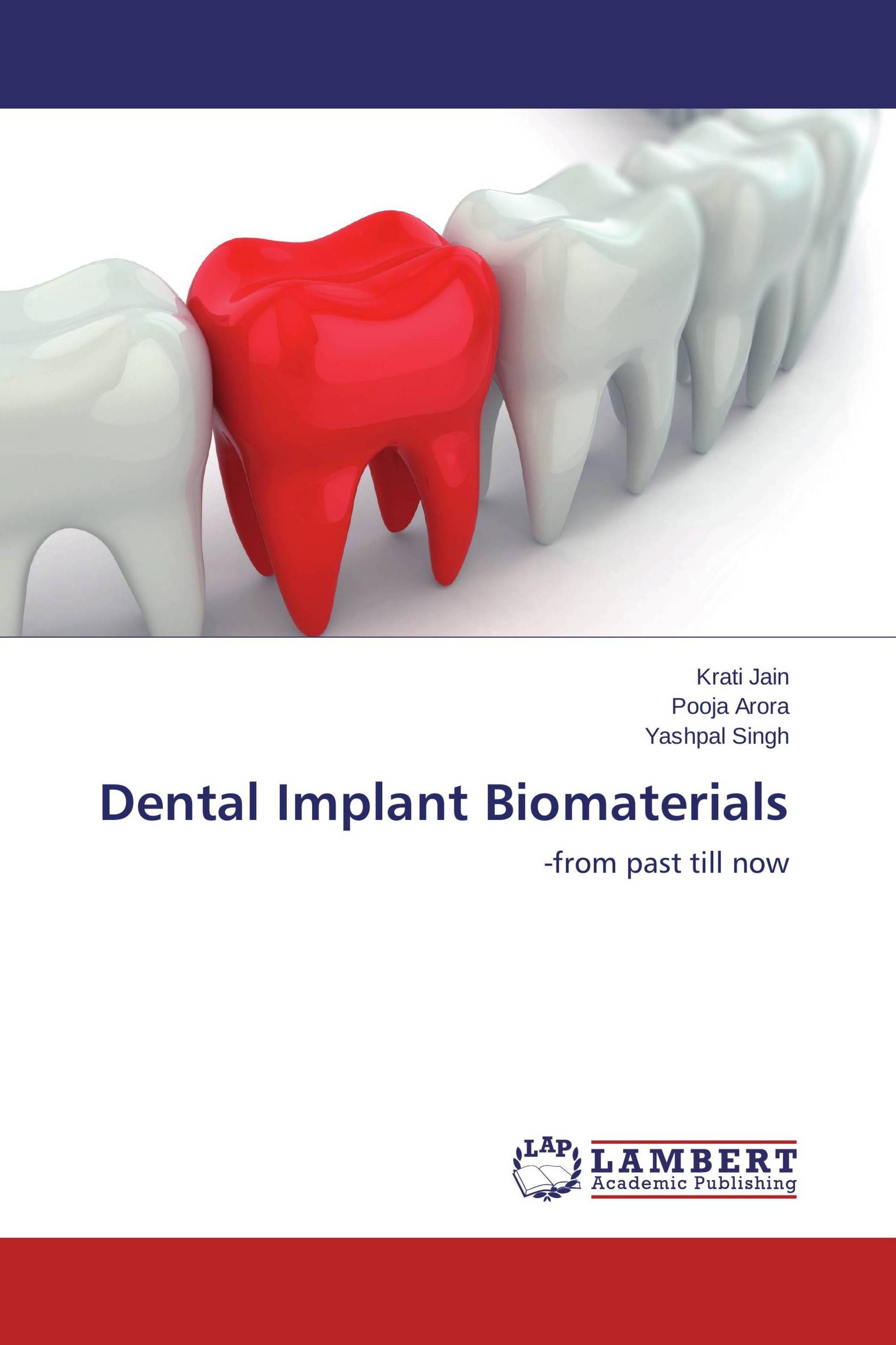 Dental Implant Biomaterials / 9783659585388 / 9783659585388