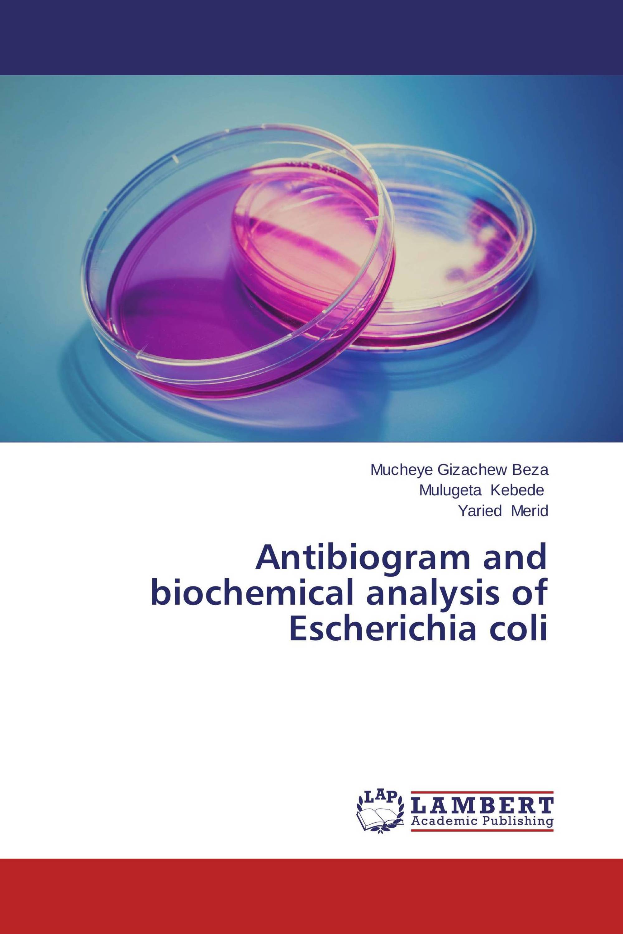 Antibiogram and biochemical analysis of Escherichia coli