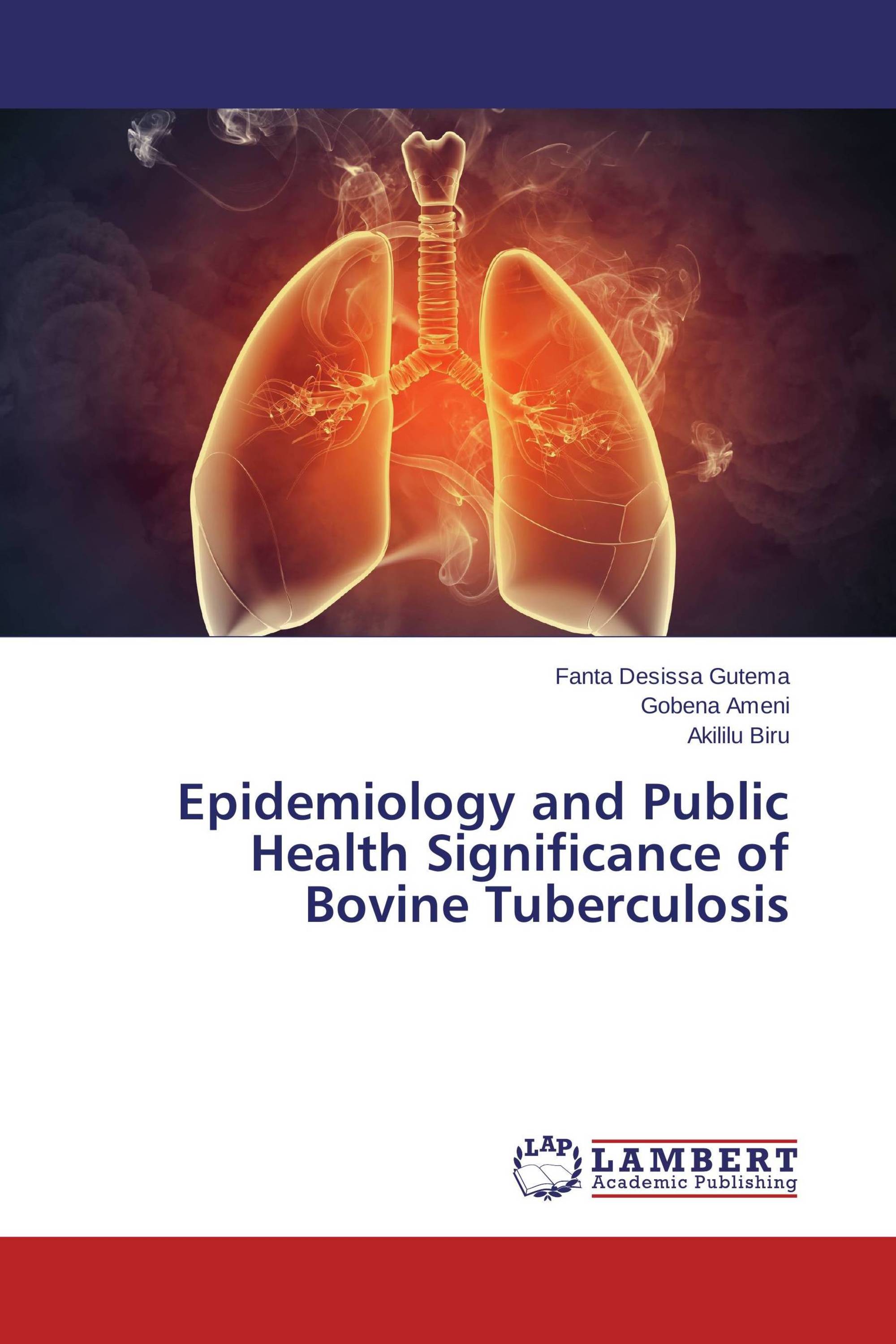 Epidemiology and Public Health Significance of Bovine Tuberculosis