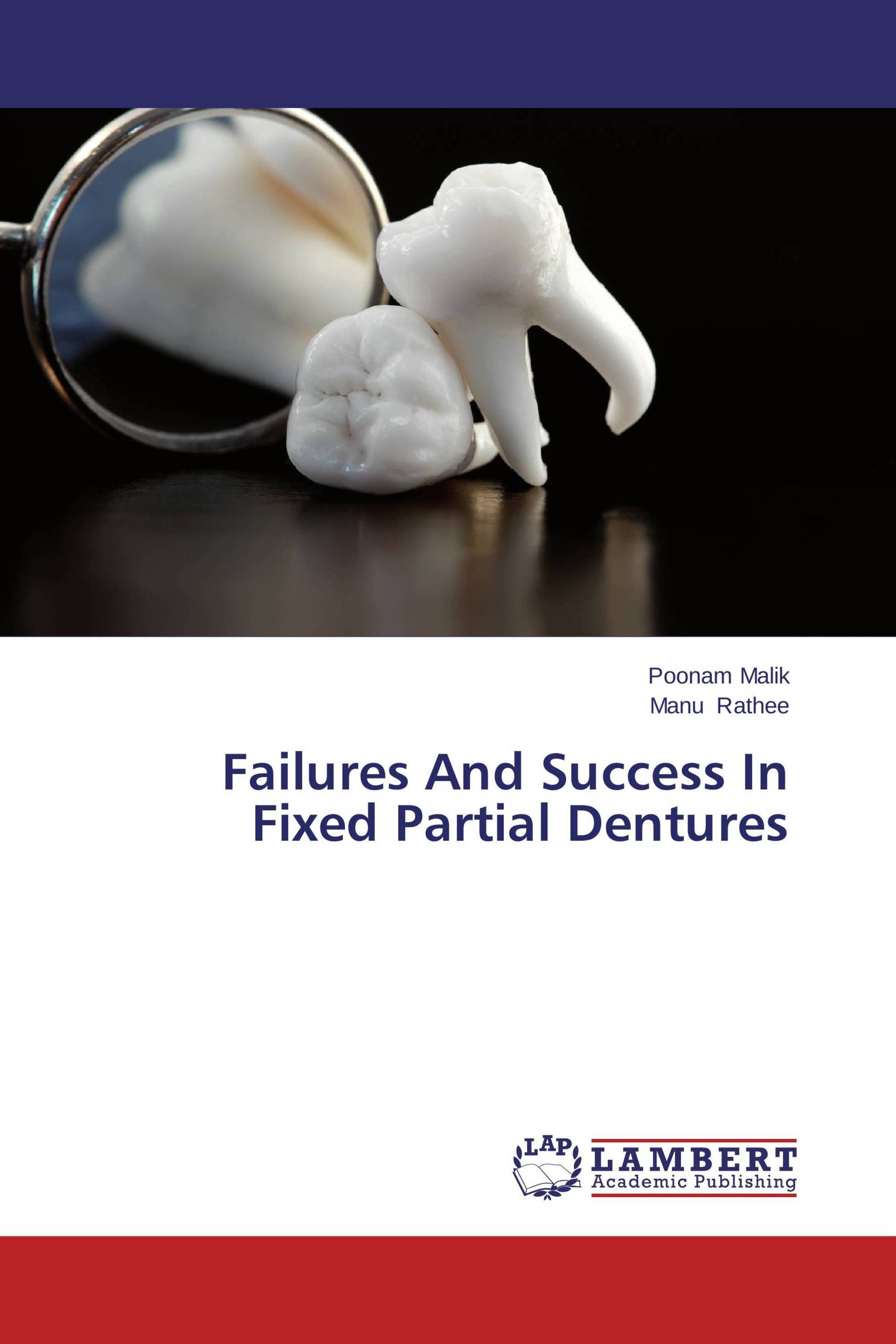 Failures And Success In Fixed Partial Dentures