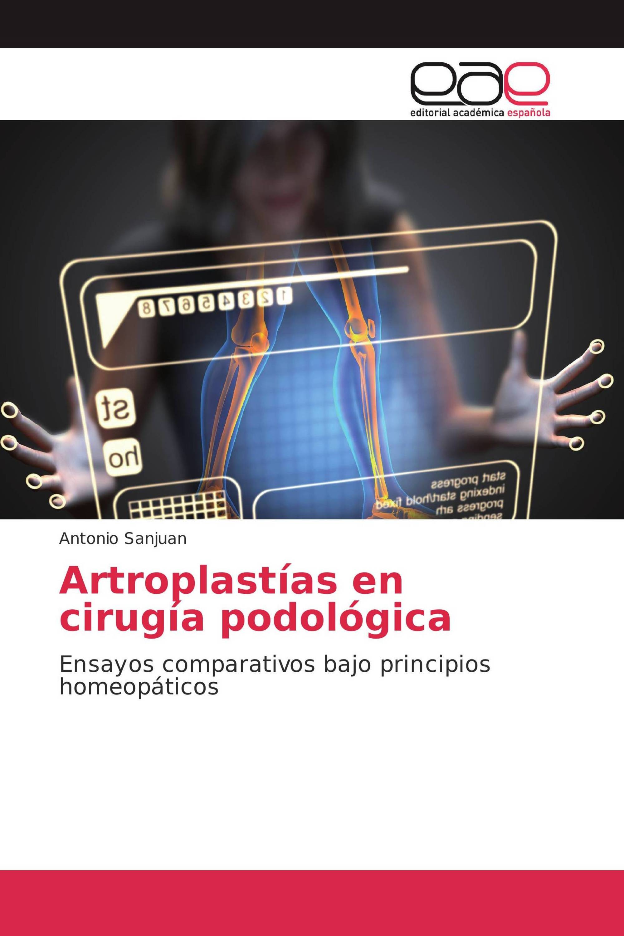 Artroplastías en cirugía podológica