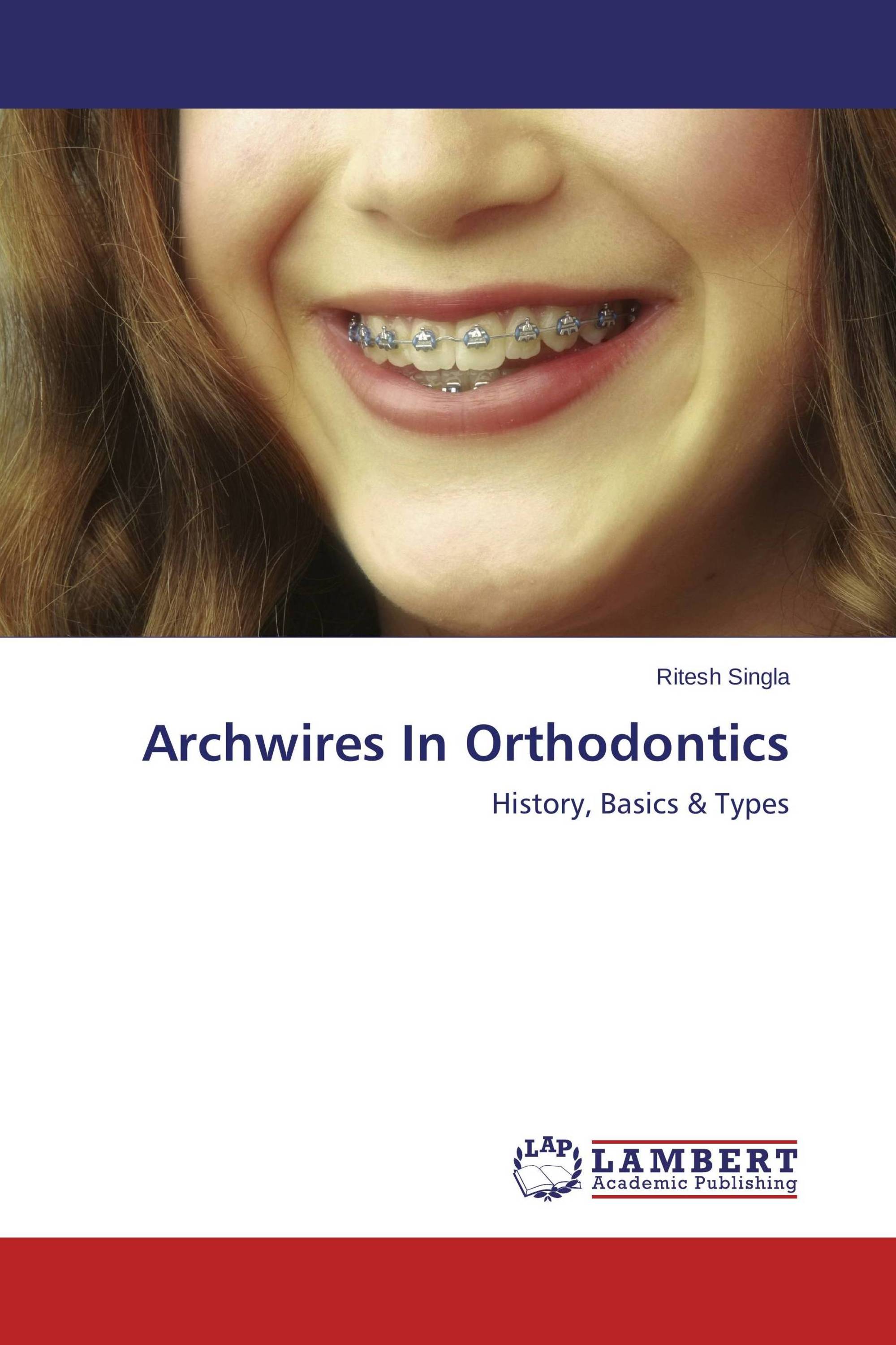Archwires In Orthodontics / 9783659673306 / 9783659673306 / 3659673307
