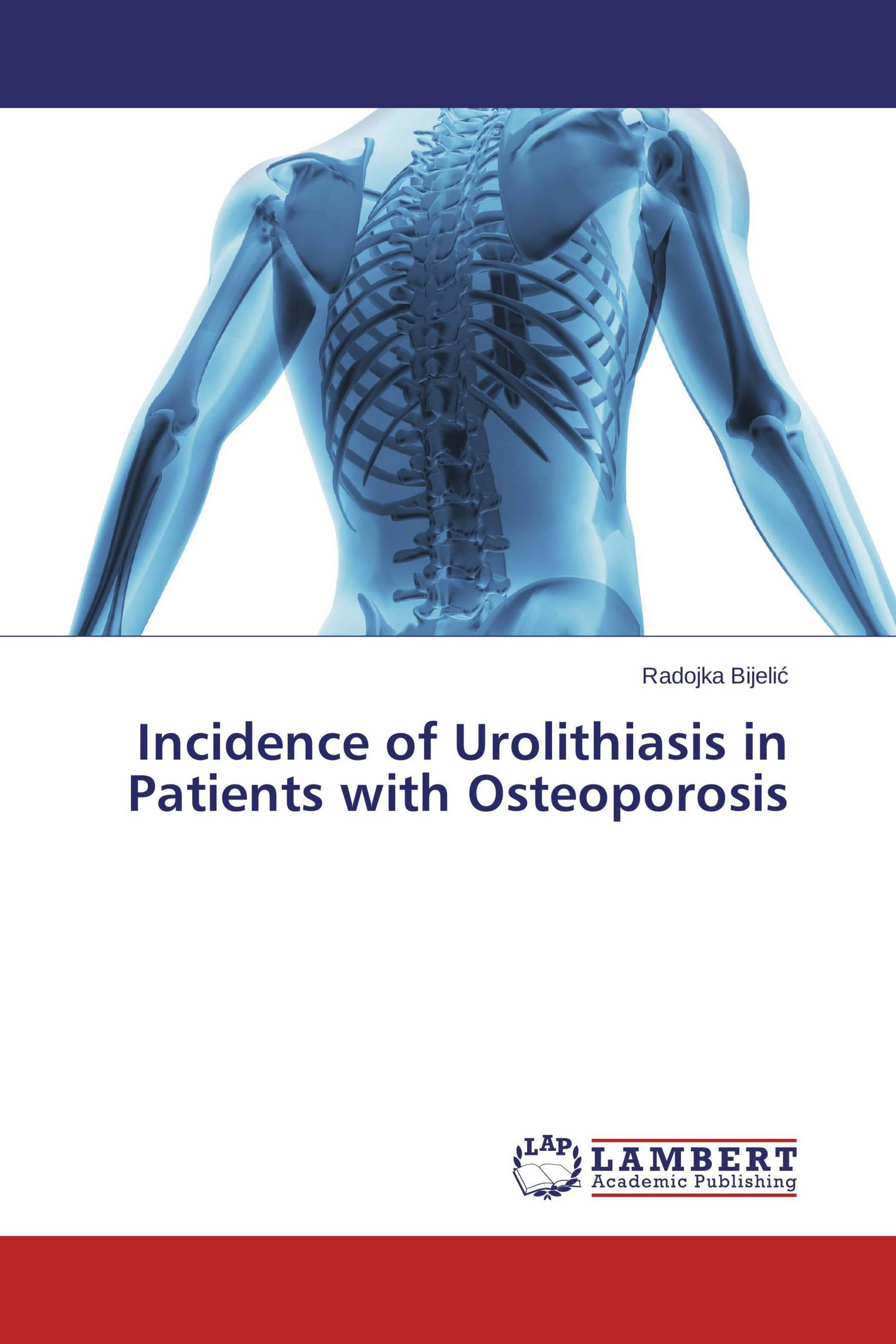 Incidence of Urolithiasis in Patients with Osteoporosis