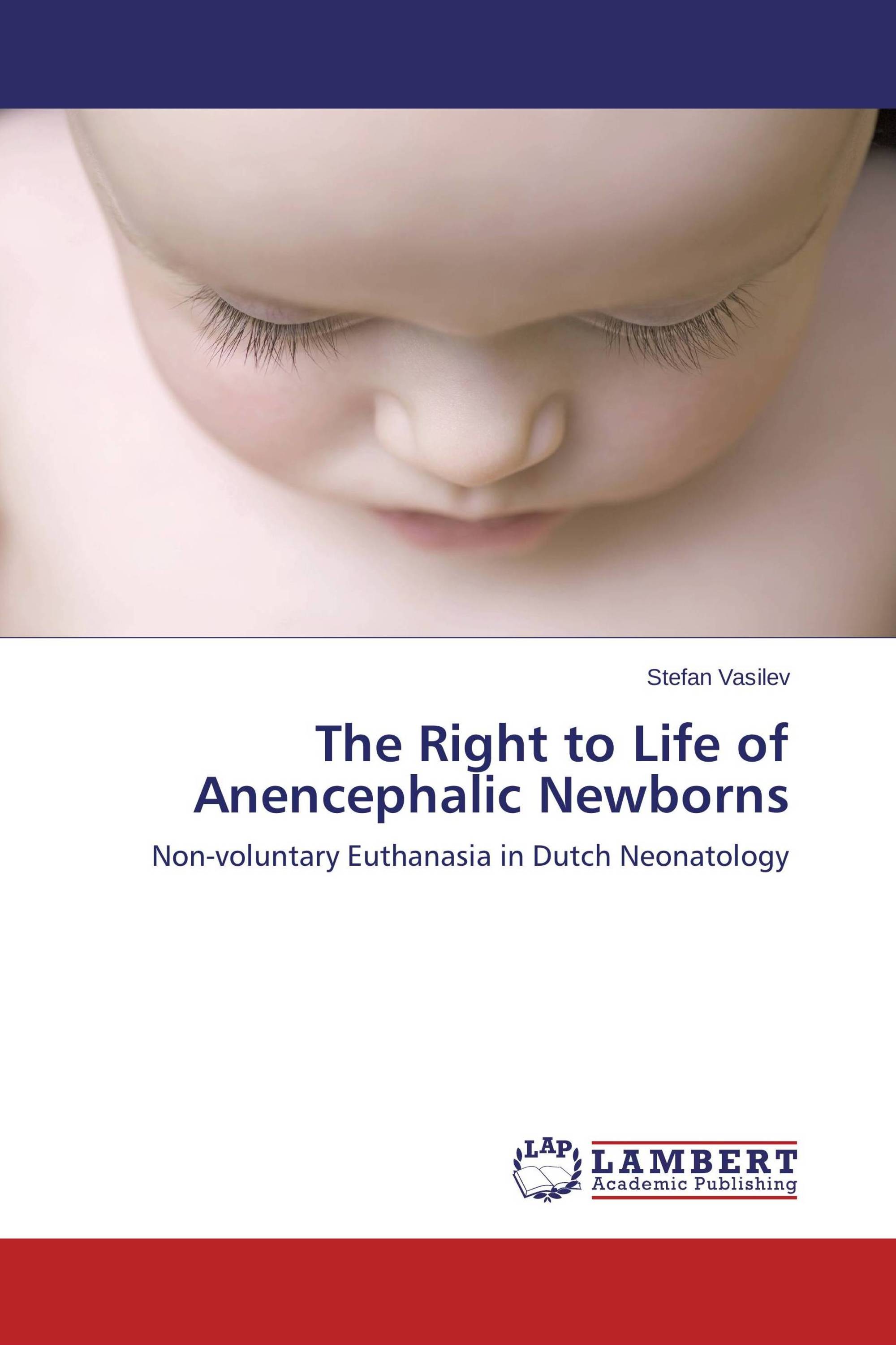 The Right to Life of Anencephalic Newborns