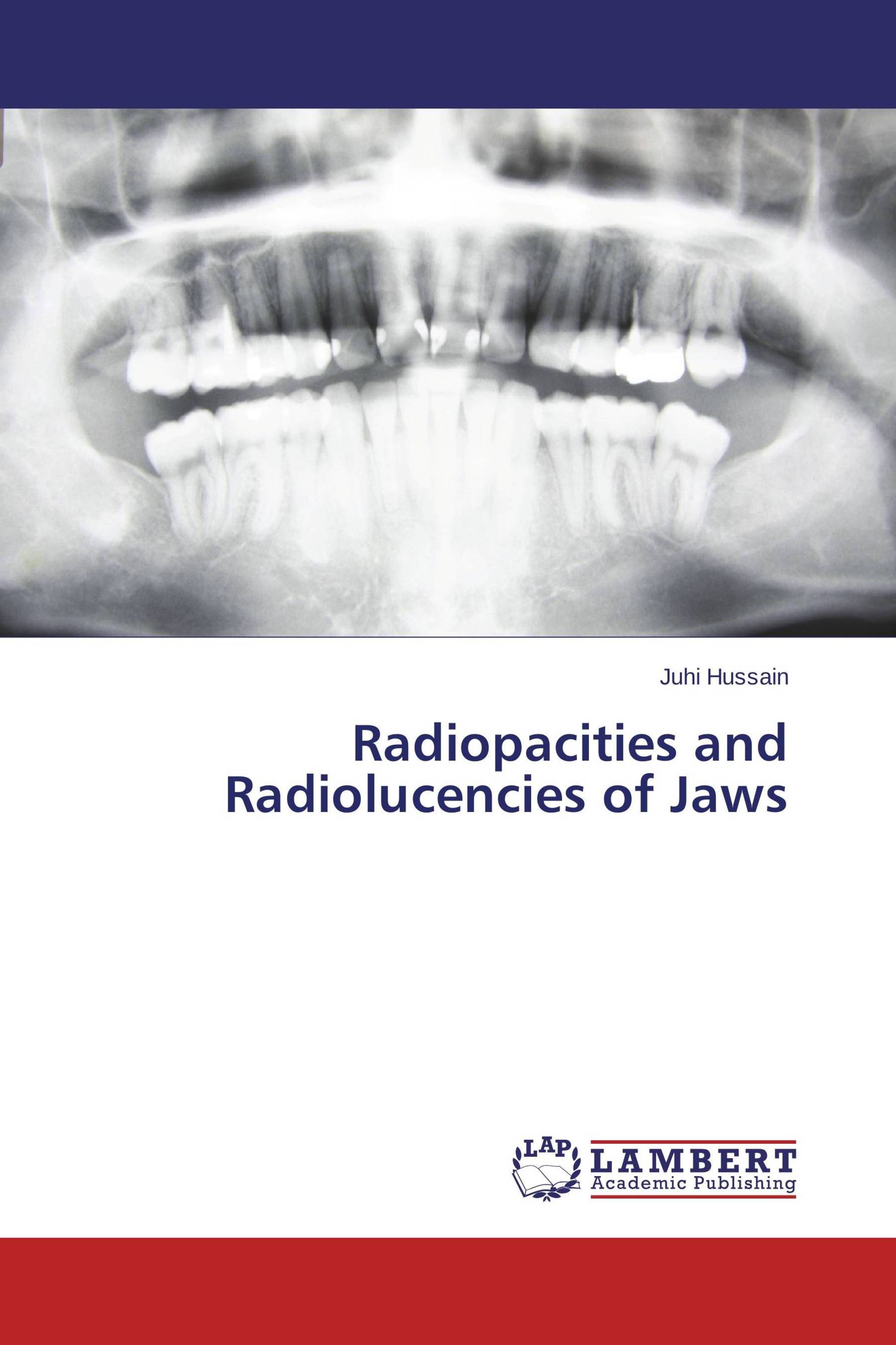 Radiopacities and Radiolucencies of Jaws