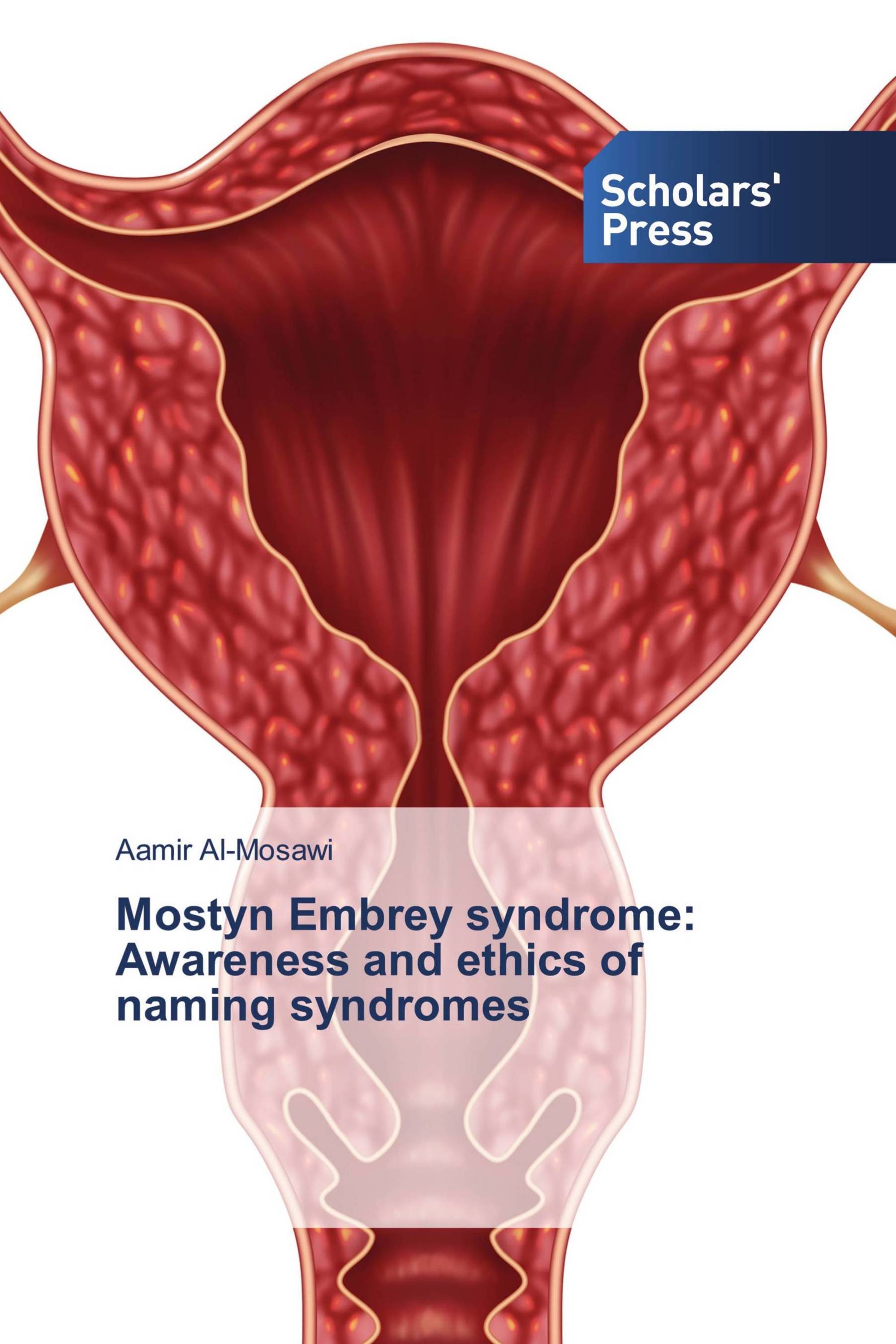 Mostyn Embrey syndrome: Awareness and ethics of naming syndromes