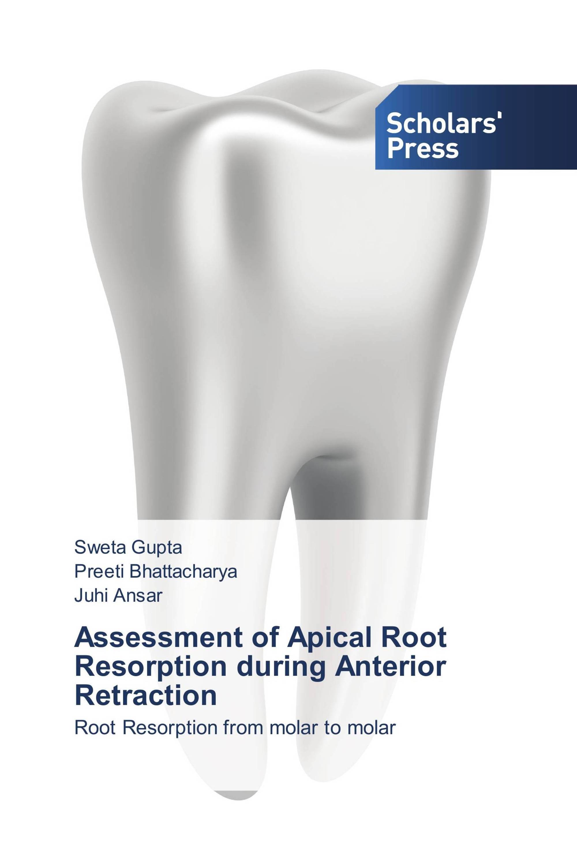 Assessment of Apical Root Resorption during Anterior Retraction