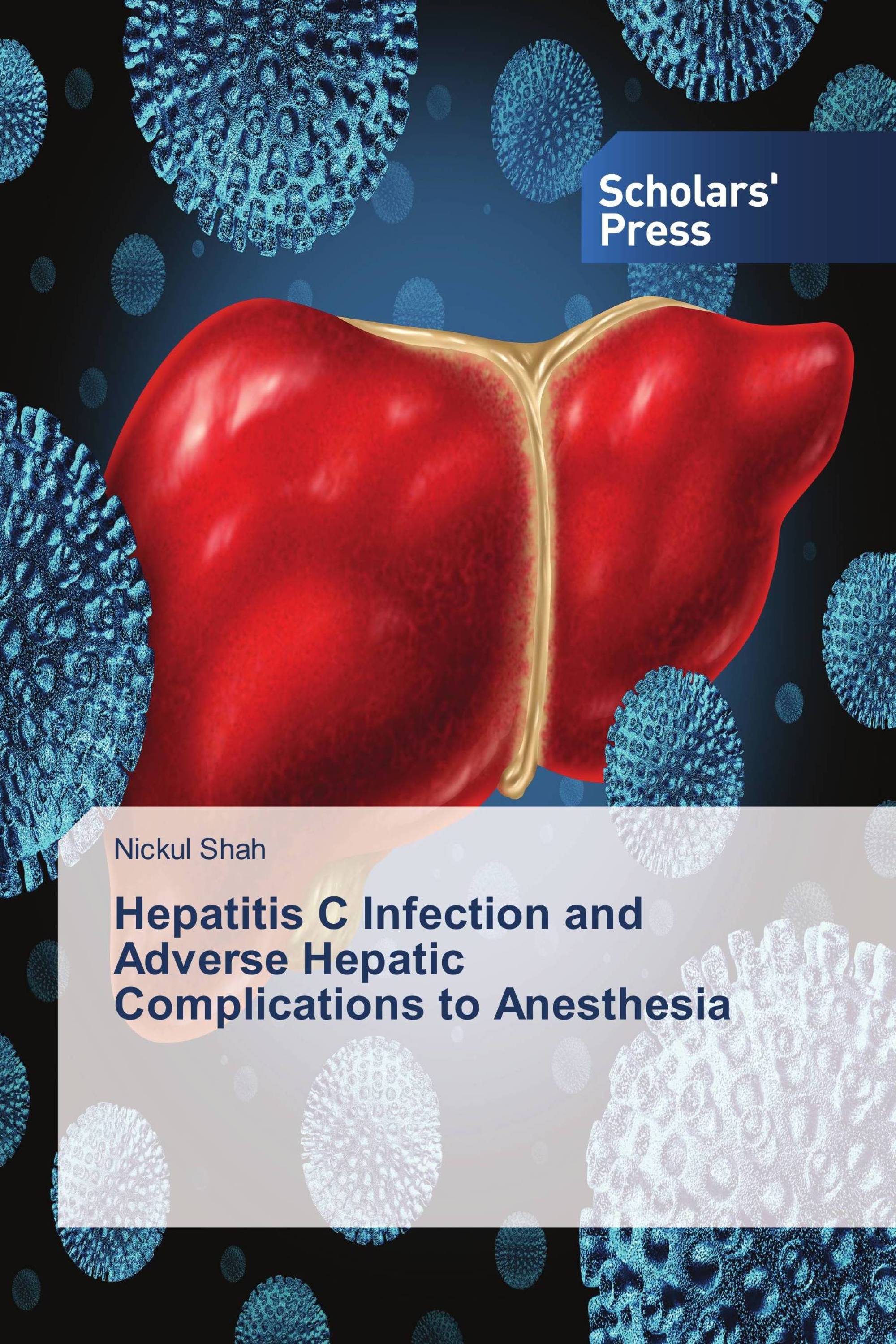 Hepatitis C Infection and Adverse Hepatic Complications to Anesthesia