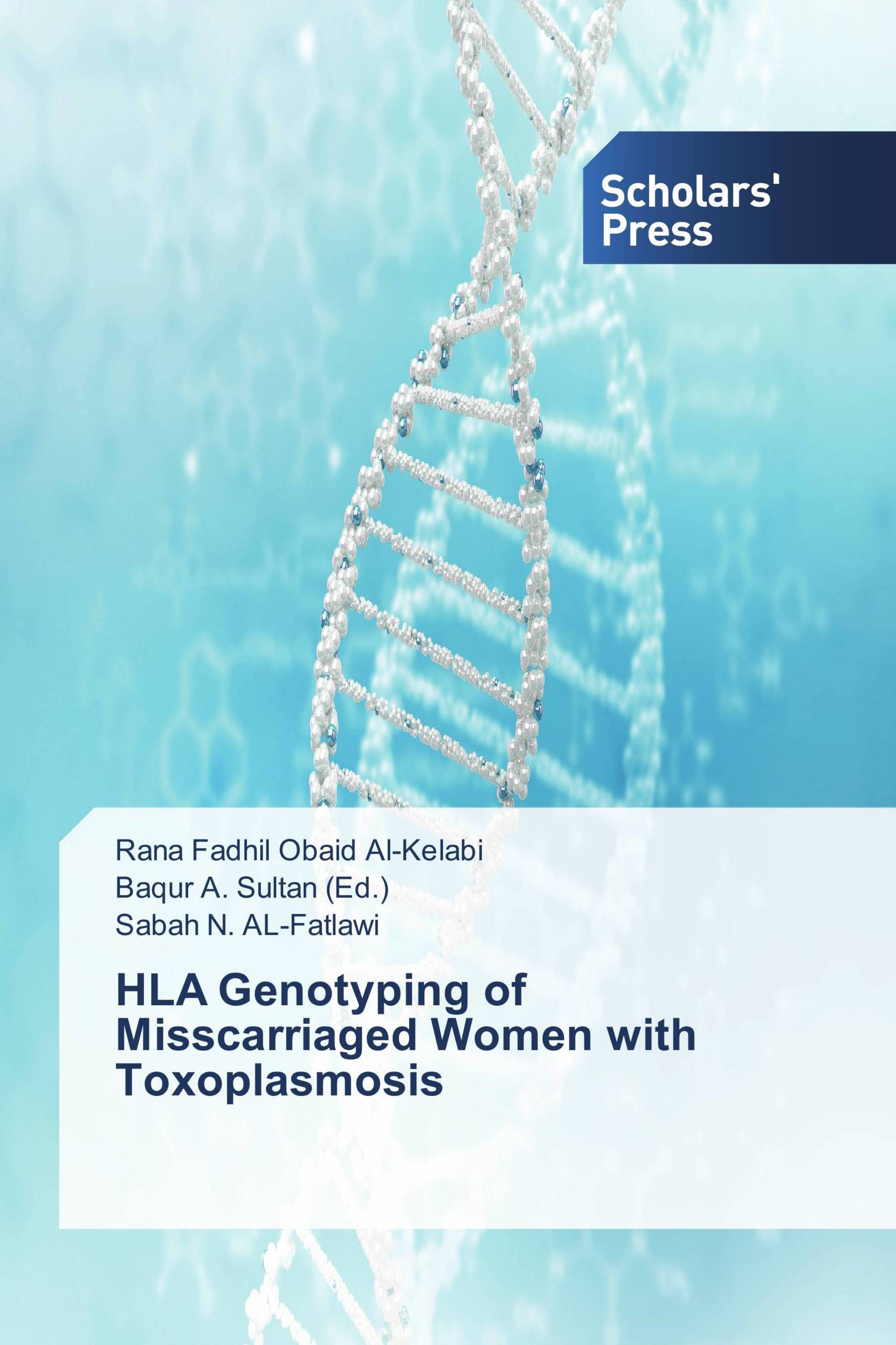 HLA Genotyping of Misscarriaged Women with Toxoplasmosis