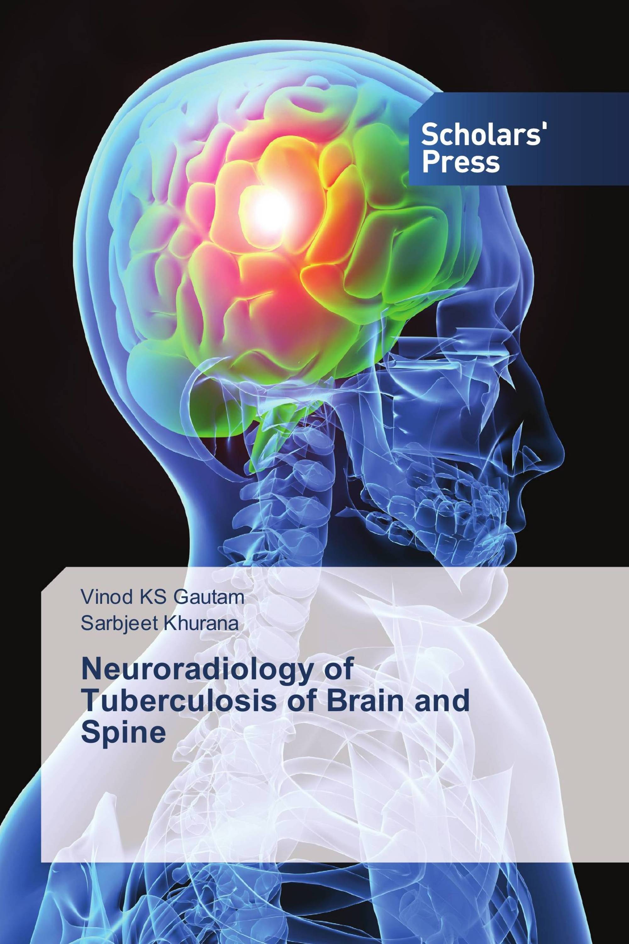 Neuroradiology of Tuberculosis of Brain and Spine