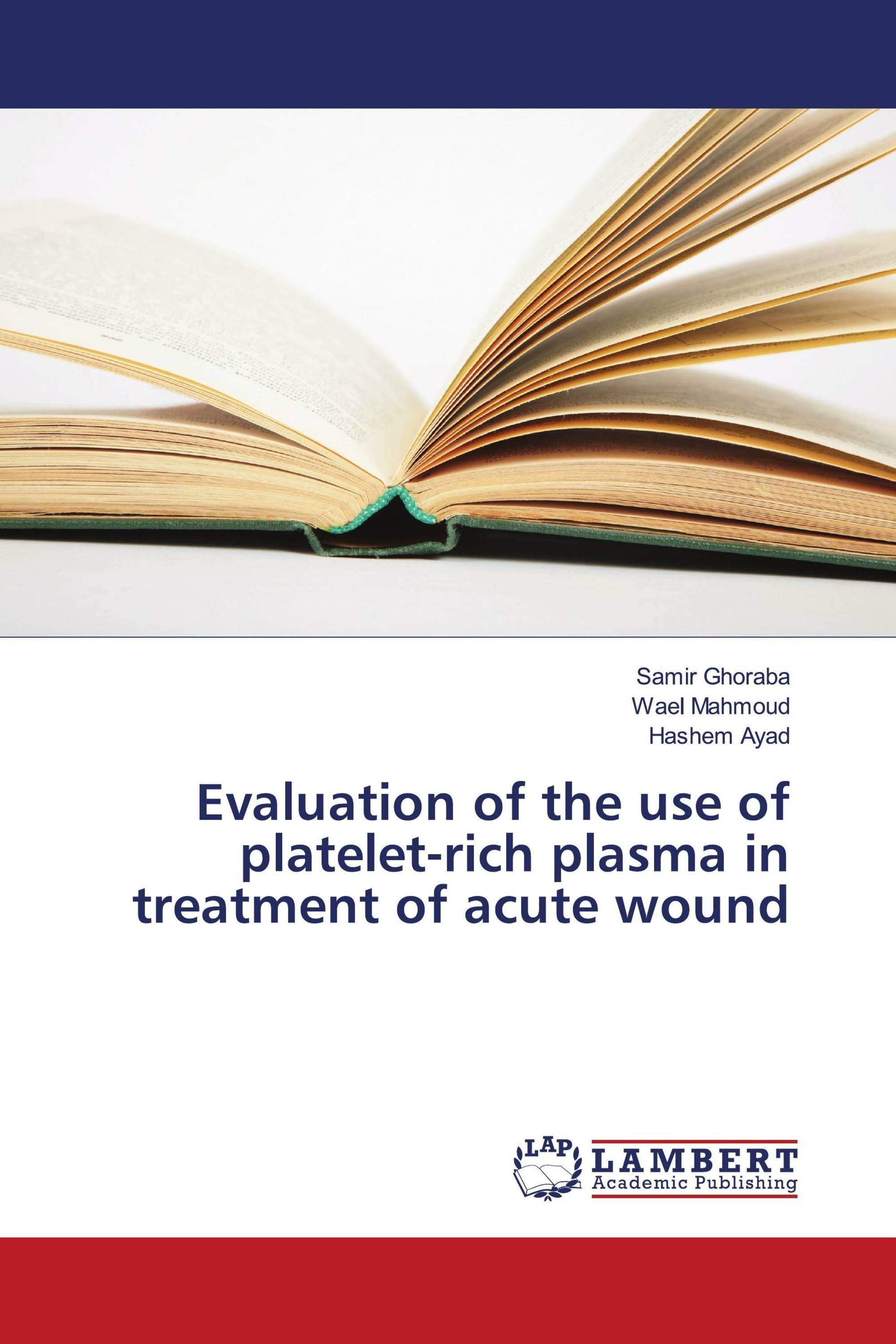 Evaluation of the use of platelet-rich plasma in treatment of acute wound