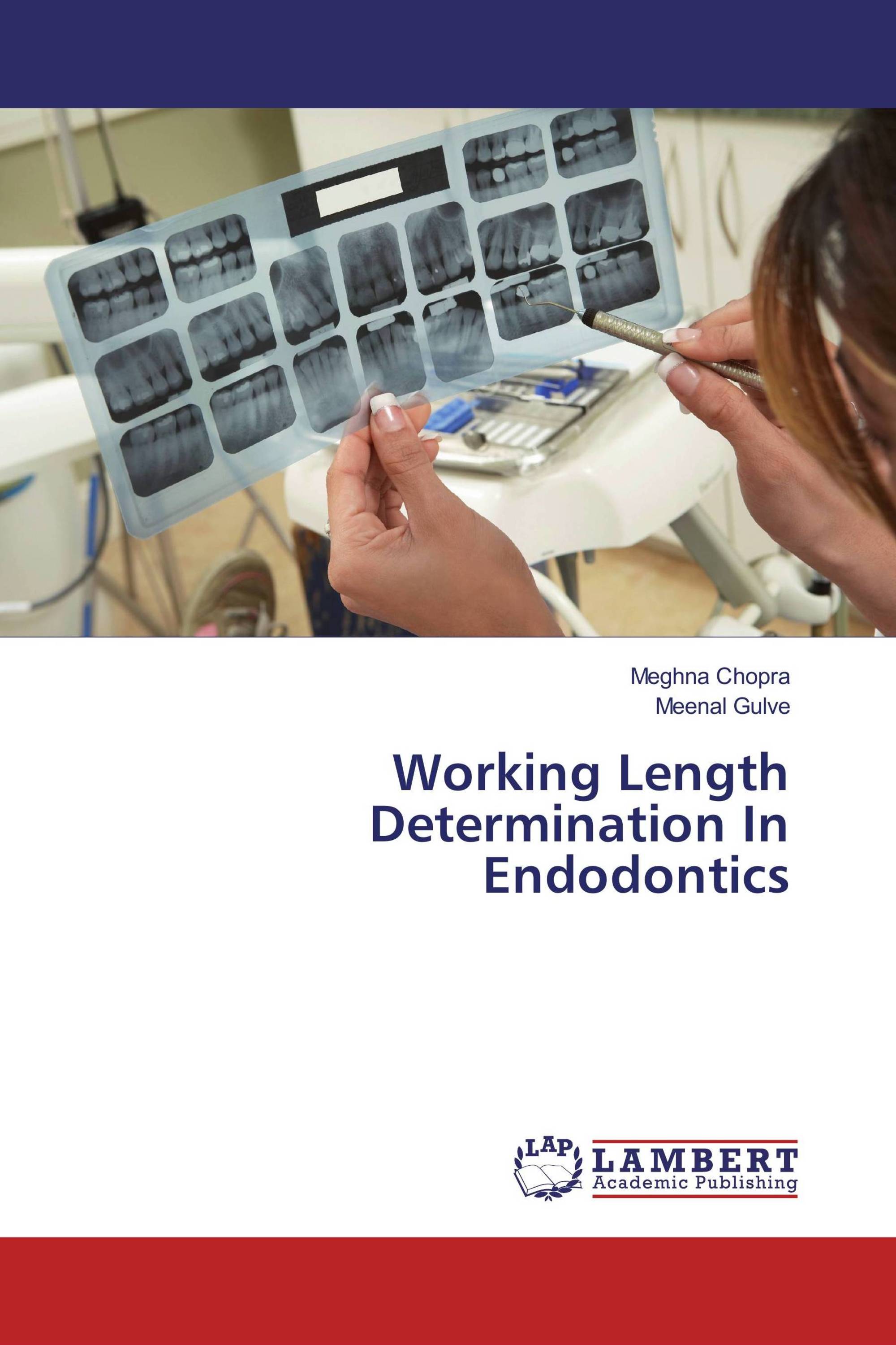 Working Length Determination In Endodontics / 978-3-659-88671-3 ...