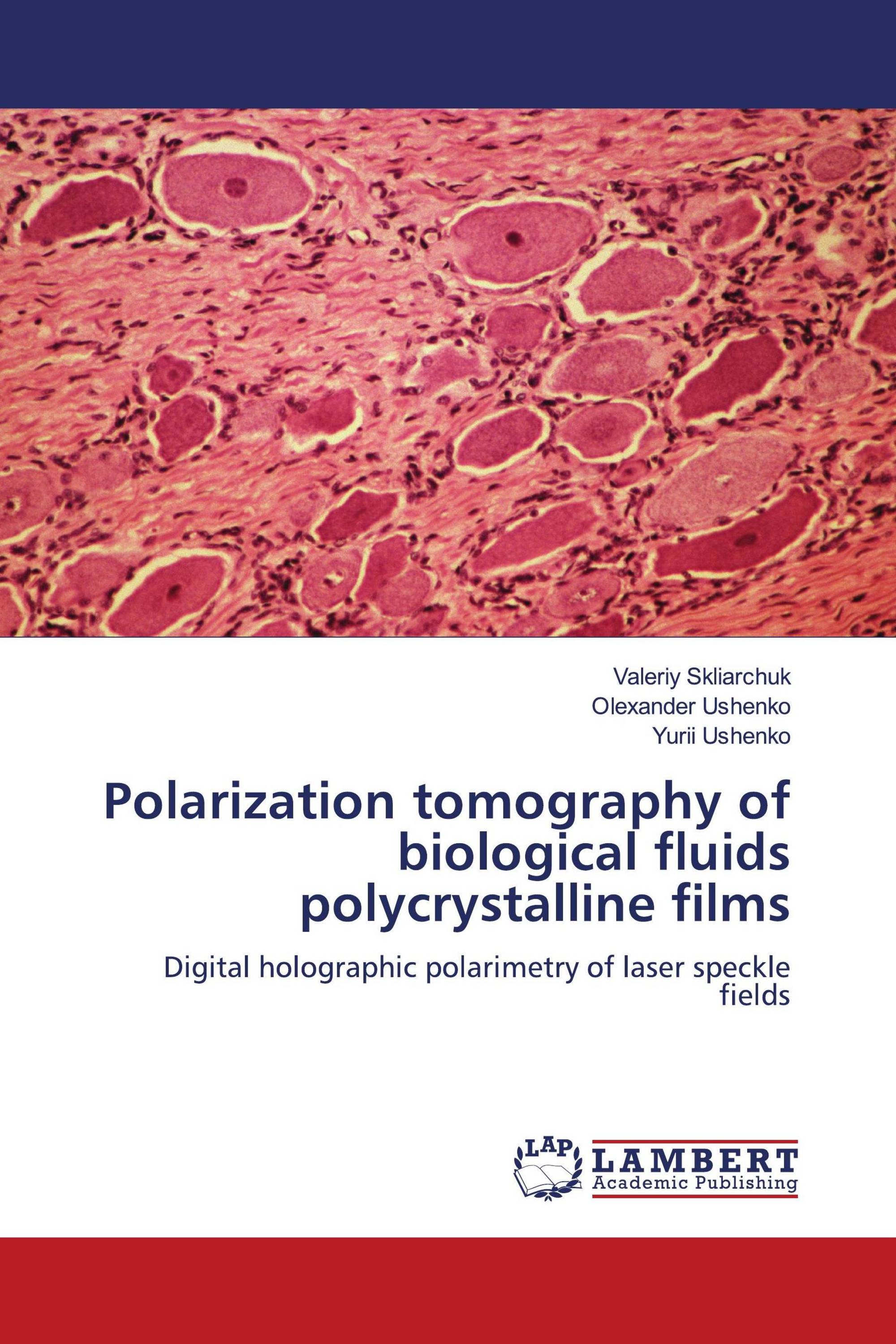 Polarization tomography of biological fluids polycrystalline films