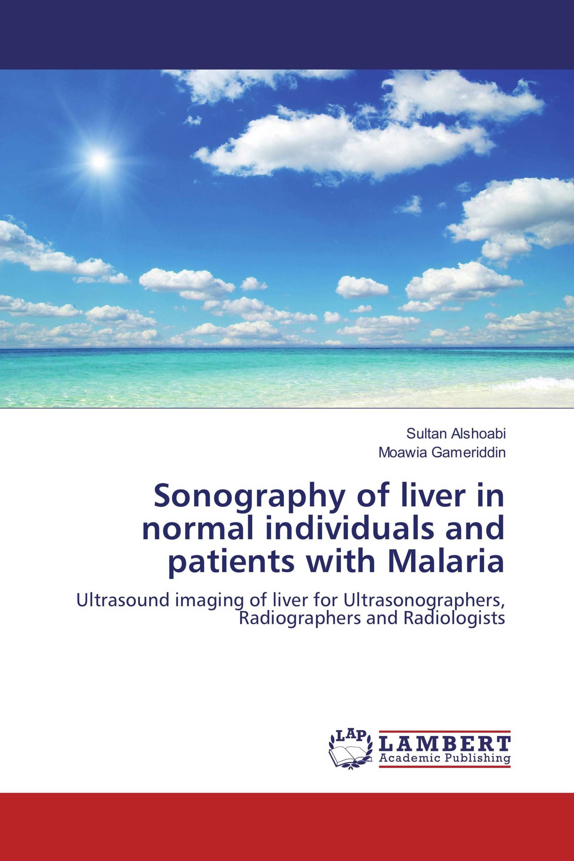 Sonography of liver in normal individuals and patients with Malaria