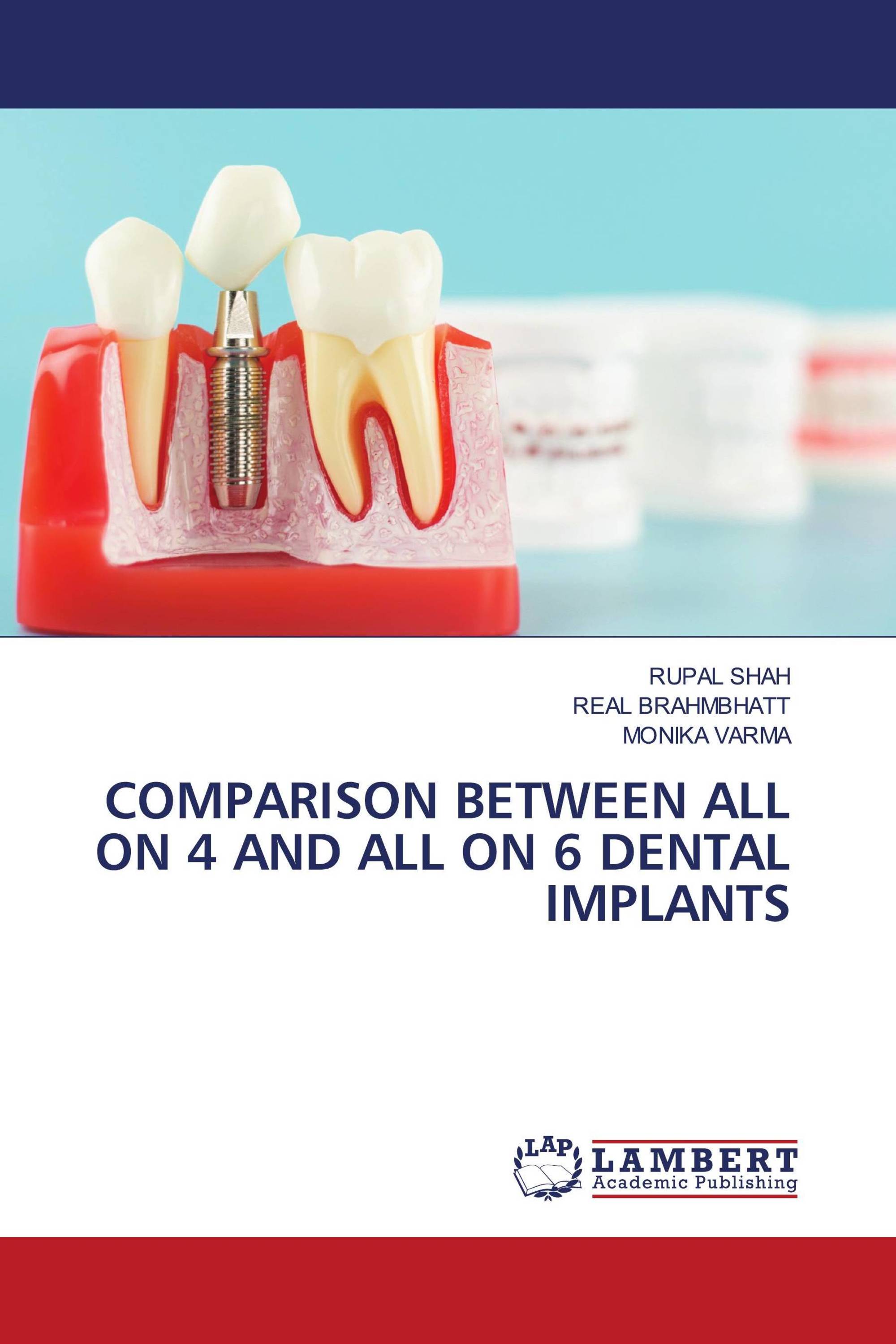 COMPARISON BETWEEN ALL ON 4 AND ALL ON 6 DENTAL IMPLANTS