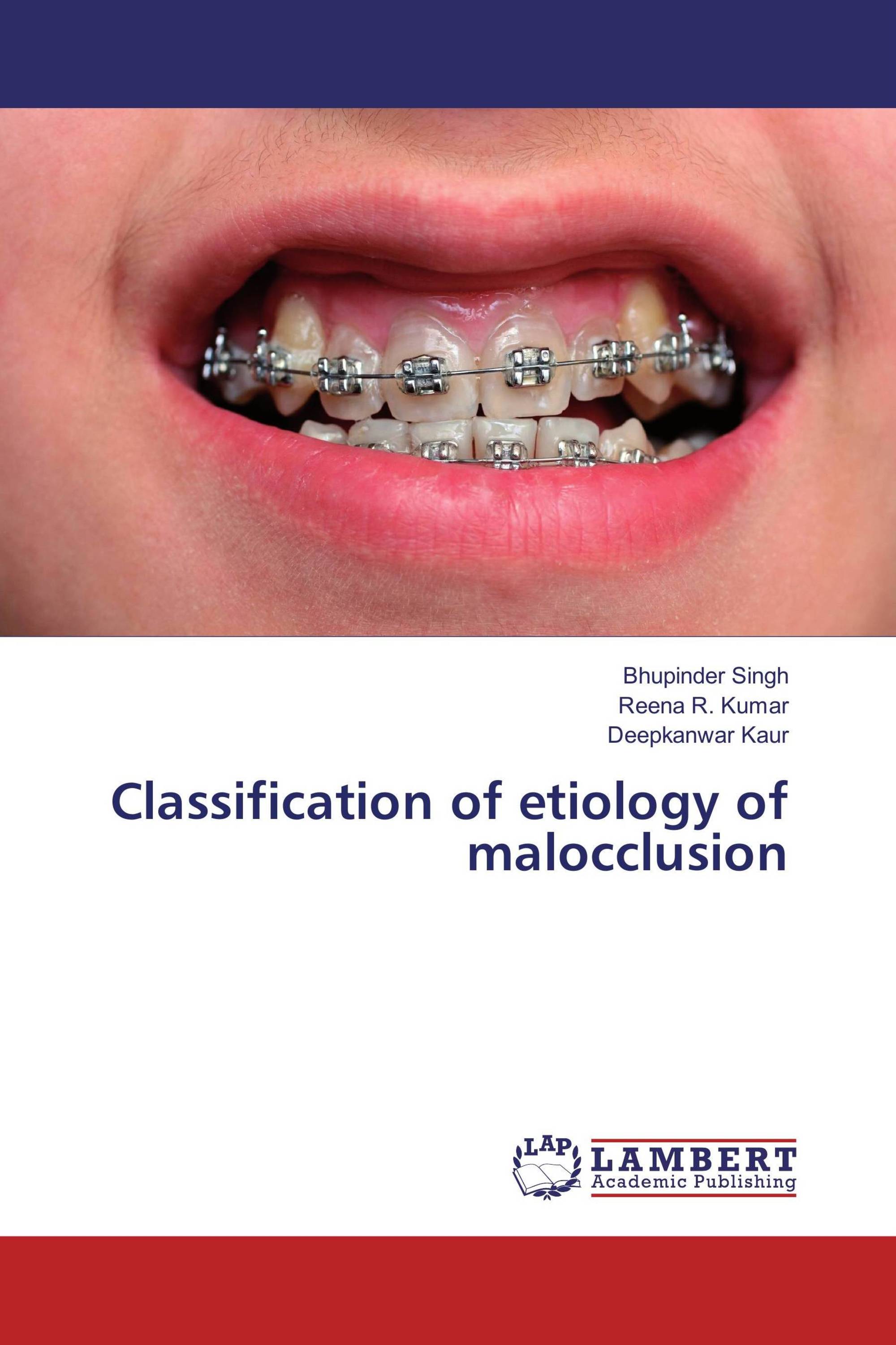 Classification of etiology of malocclusion