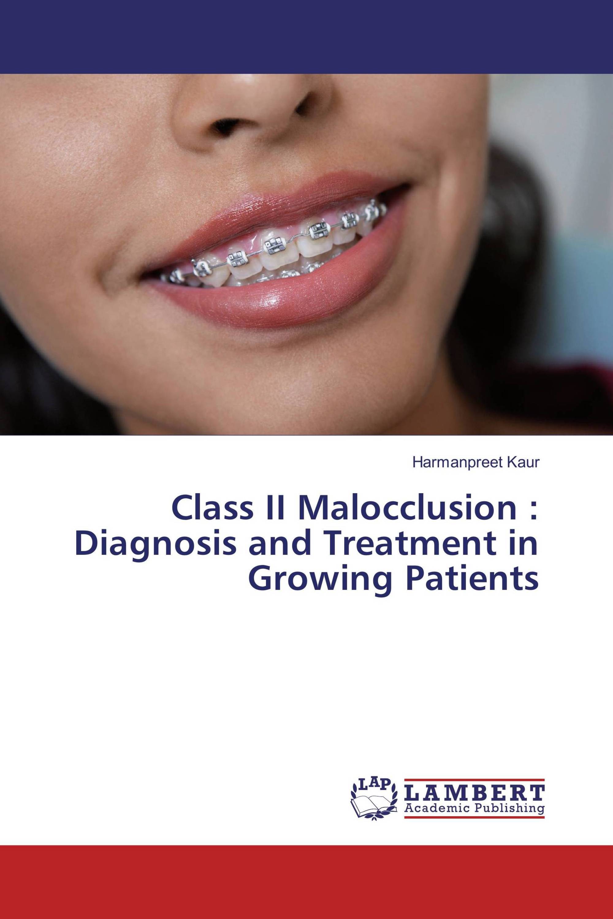 Class II Malocclusion : Diagnosis and Treatment in Growing Patients