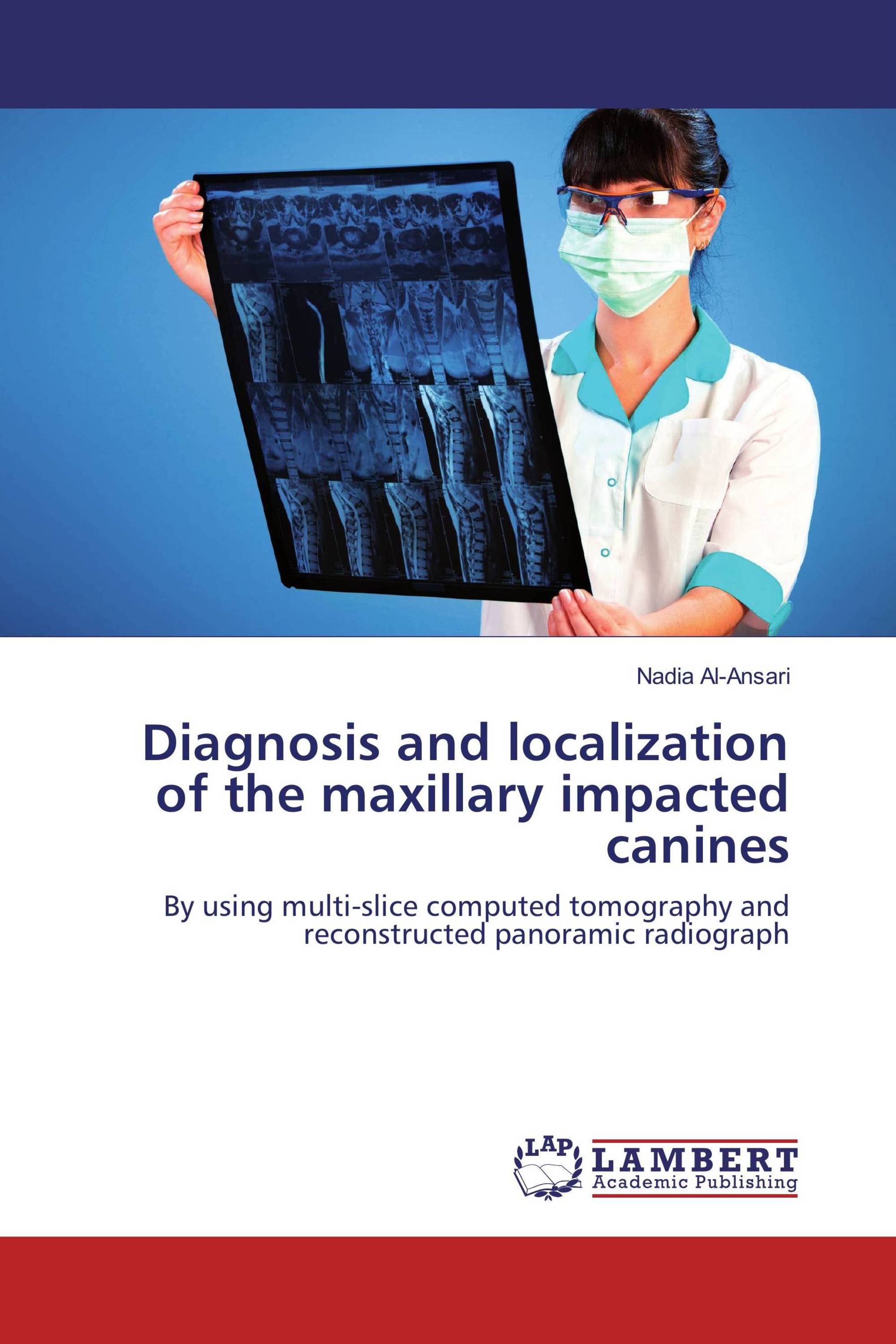 Diagnosis and localization of the maxillary impacted canines