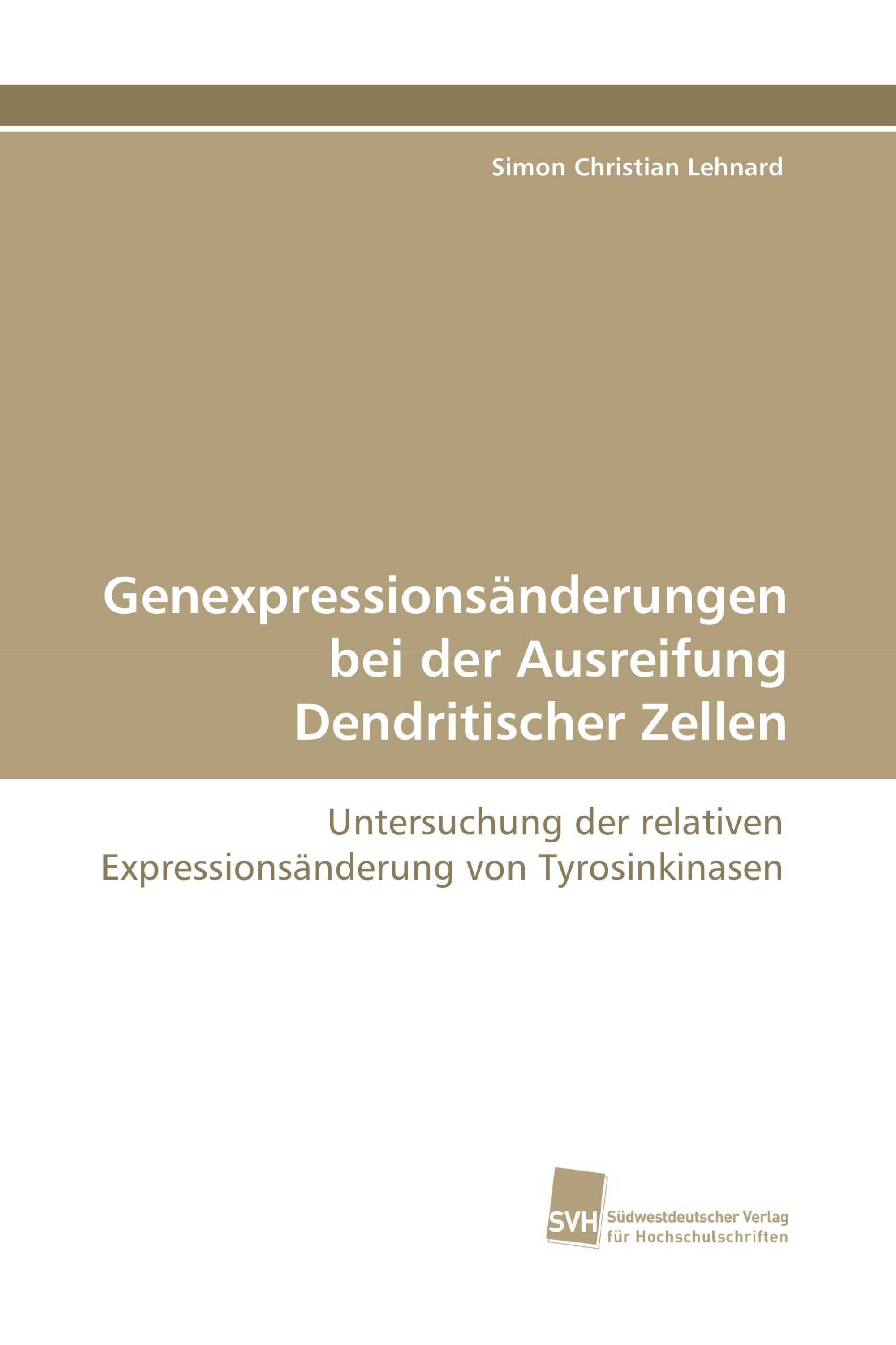 Genexpressionsänderungen bei der Ausreifung Dendritischer Zellen