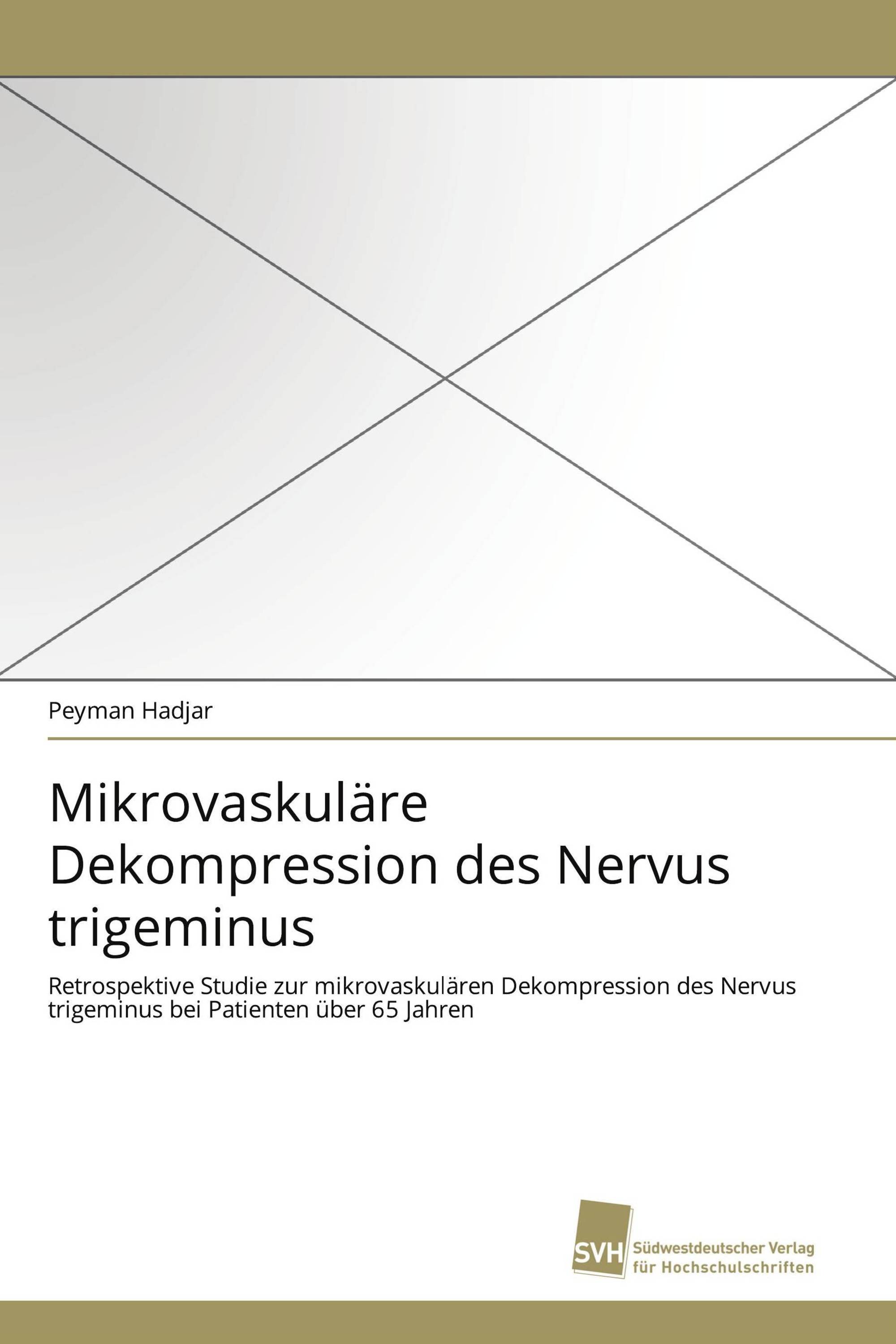 Mikrovaskuläre Dekompression des Nervus trigeminus