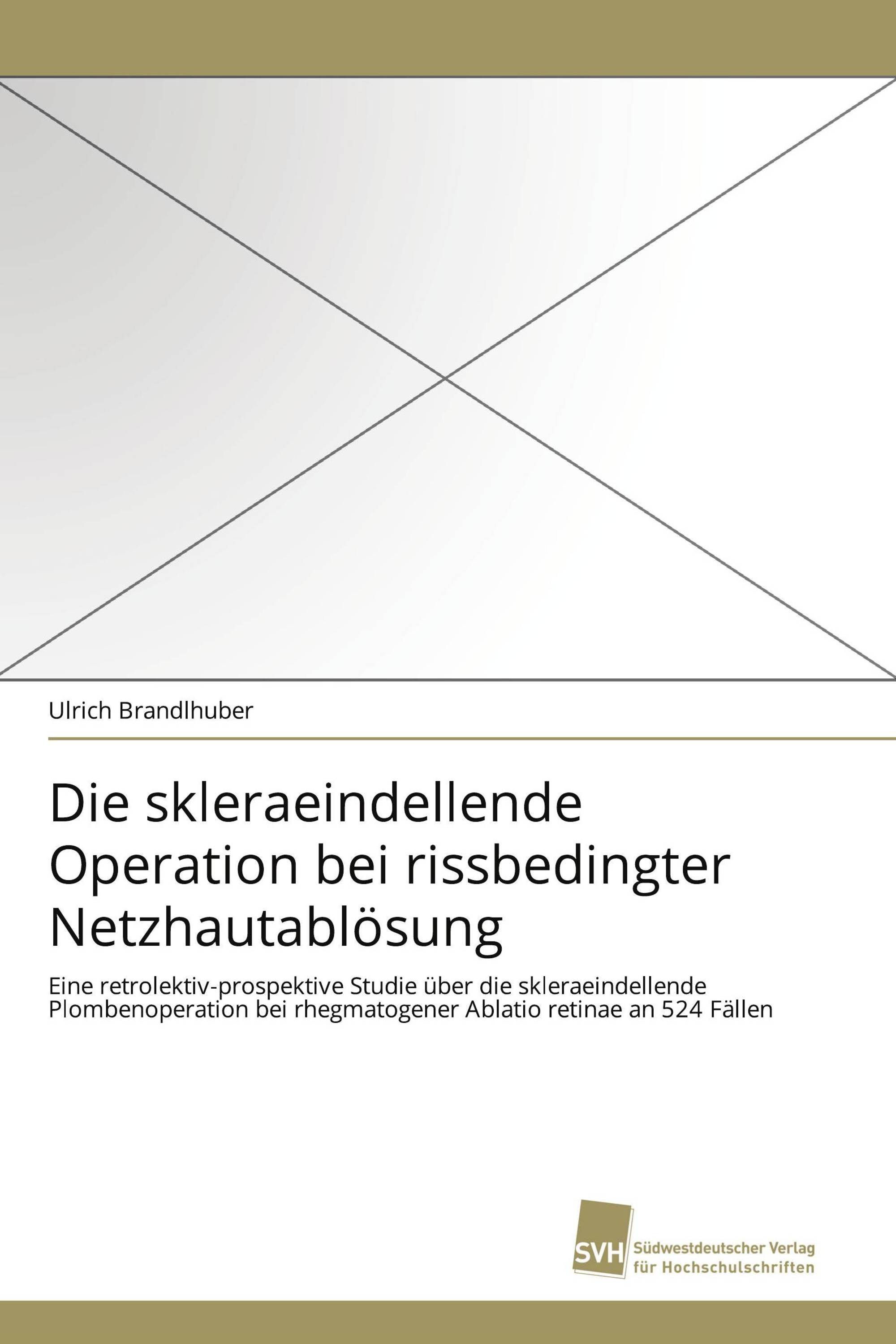 Die skleraeindellende Operation bei rissbedingter Netzhautablösung