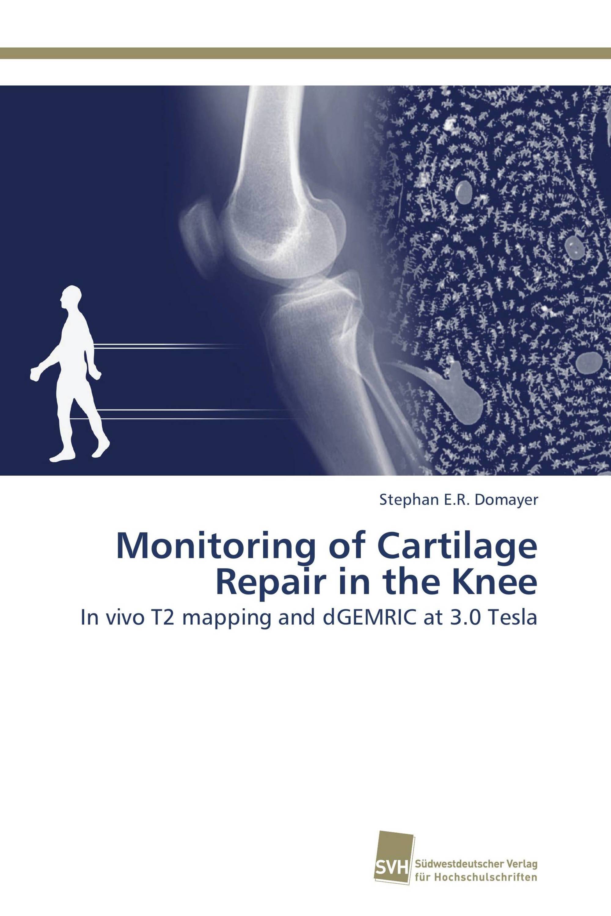 Monitoring of Cartilage Repair in the Knee